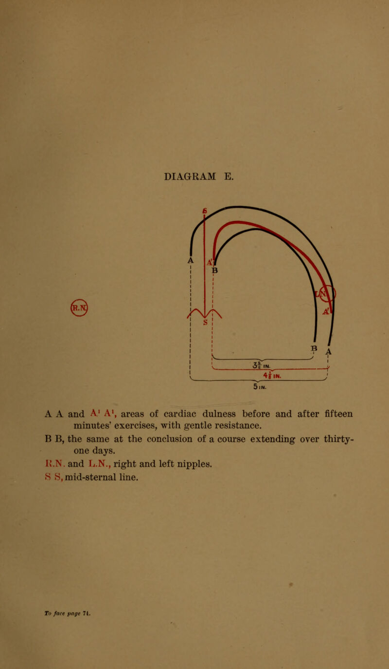 © 5 IN. A A and A1 A1, areas of cardiac dulness before and after fifteen minutes' exercises, with gentle resistance. B B, the same at the conclusion of a course extending over thirty- one days. I J.N. and L.N., right and left nipples. S S. mid-sternal line.