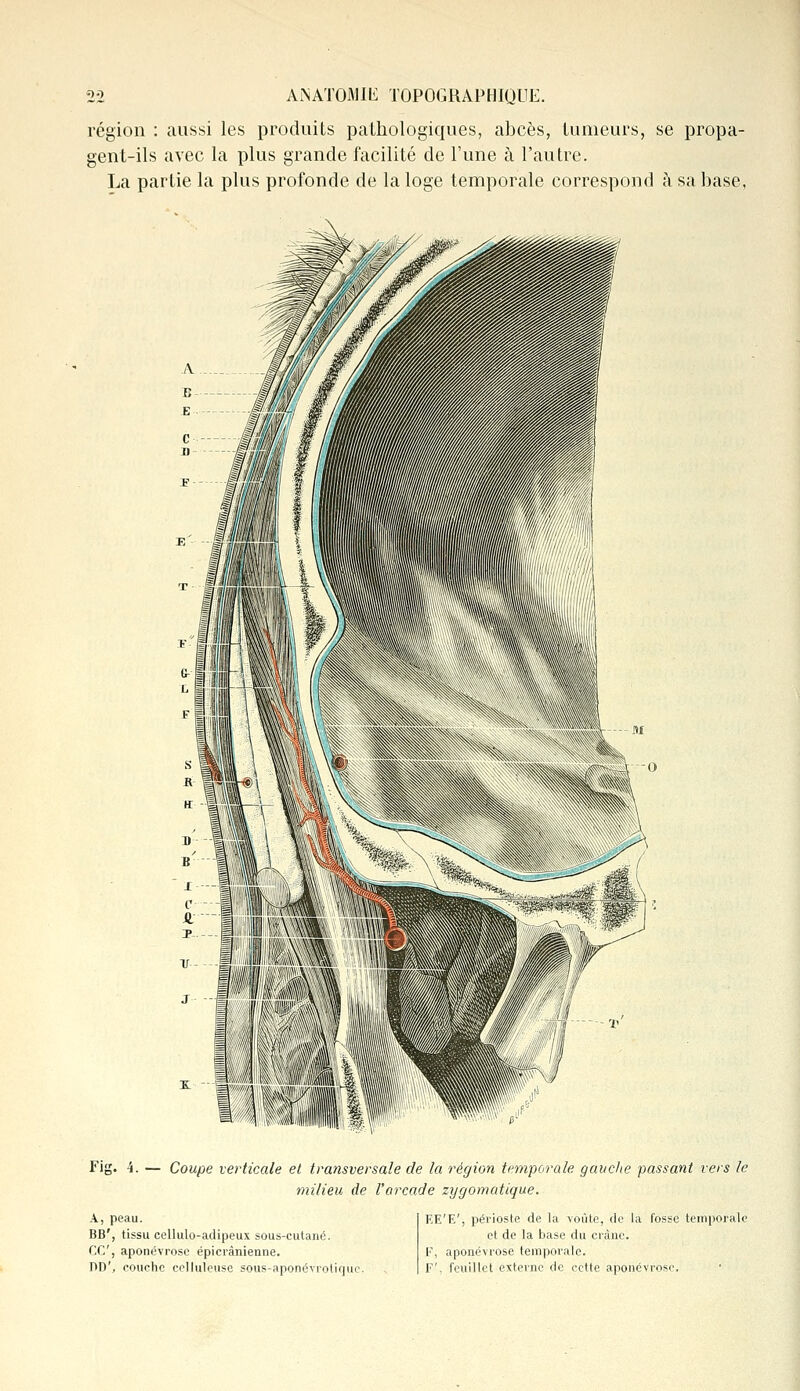 région : aussi les produits pathologiques, abcès, tumeurs, se propa- gent-ils avec la plus grande facilité de l'une à l'autre. La partie la plus profonde de la loge temporale correspond à sa base, Fig. -i. — Coupe verticale et transversale de la région temporale gauche passant vers le milieu de l'arcade zygomatique. A, peau. BB', tissu eellulo-adipeux sous-cutané. CC, aponévrose épicrânienne. DD', couche celluleuse sous-aponévrotique EE'E', périoste de la voûte, de la fosse temporale et de la base du crâne. F, aponévrose temporale. F', feuillet externe de cette aponévrose.