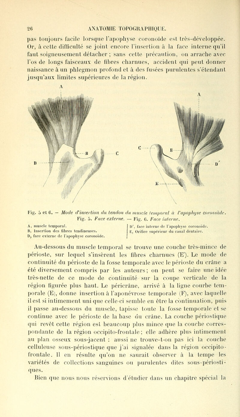 pas toujours facile lorsque l'apophyse coronoïde est très-développée. Or, à cette difficulté se joint encore l'insertion à la face interne qu'il faut soigneusement détacher ; sans cette précaution, on arrache avec l'os de longs faisceaux de fibres charnues, accident qui peut donner naissance à un phlegmon profond et à des fusées purulentes s'étendant jusqu'aux limites supérieures de la région. A A C.....Z Fig. 5 et 6. — Mode d'insertion du tendon du muscle temporal à l'apophyse coronoïde. Fig. 5. Face externe. — Fia-. G. Face interne. A, muselé temporal. B, Insertion des fibres tendineuses. D, face externe de l'apophyse coronoïde. D', face interne de l'apophyse coronoïde. E, Orifice supérieur du canal dentaire. Au-dessous du muscle temporal se trouve une couche très-mince de périoste, sur lequel s'insèrent les fibres charnues (E'). Le mode de continuité du périoste de la fosse temporale avec le périoste du crâne a été diversement compris par les auteurs ; on peut se faire une idée très-nette de ce mode de continuité sur la coupe verticale de la région figurée plus haut. Le péricrâne, arrivé à la ligne courbe tem- porale (E), donne insertion à l'aponévrose temporale (F), avec laquelle il est si intimement uni que celle-ci semble en être la continuation, puis il passe au-dessous du muscle, tapisse toute la fosse temporale et se continue avec le périoste de la base du crâne. La couche périostique qui revêt cette région est beaucoup plus mince que la couche corres- pondante de la région occipito-frontale; elle adhère plus intimement au plan osseux sous-jacent : aussi ne trouve-t-on pas ici la couche celluleuse sous-périostique que j'ai signalée dans la région occipito- frontale. 11 en résulte qu'on ne saurait observer à la tempe les variétés de collections sanguines ou purulentes diles sous-périosti- ques. Bien que nous nous réservions d'étudier dans un chapitre spécial la