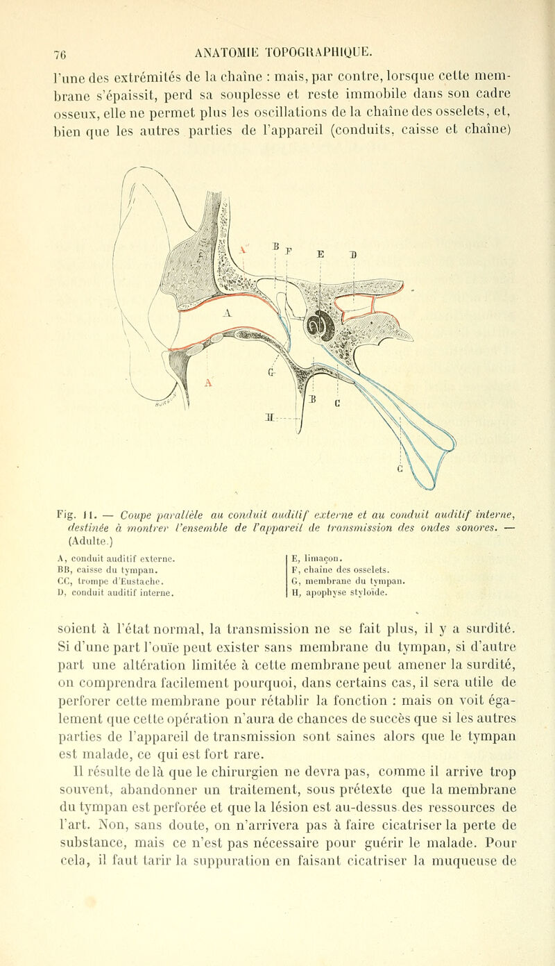 l'une des extrémités de la chaîne : mais, par contre, lorsque cette mem- brane s'épaissit, perd sa souplesse et reste immobile dans son cadre osseux, elle ne permet plus les oscillations de la chaîne des osselets, et, bien que les autres parties de l'appareil (conduits, caisse et chaîne) Fig. 11. — Coupe parallèle au conduit auditif externe et au conduit auditif interne, destinée à montrer l'ensemble de l'appareil de transmission des ondes sonores. — (Adulte.) A, conduit auditif externe. BB, caisse du tympan. CC, trompe d'Eustache. D, conduit auditif interne. E, limaçon. F, chaîne des osselets. G, membrane du tympan. H, apophyse styloïde. soient à l'état normal, la transmission ne se fait plus, il y a surdité. Si d'une part l'ouïe peut exister sans membrane du tympan, si d'autre part une altération limitée à cette membrane peut amener la surdité, on comprendra facilement pourquoi, dans certains cas, il sera utile de perforer cette membrane pour rétablir la fonction : mais on voit éga- lement que cette opération n'aura de chances de succès que si les autres parties de l'appareil de transmission sont saines alors que le tympan est malade, ce qui est fort rare. Il résulte delà que le chirurgien ne devra pas, comme il arrive trop souvent, abandonner un traitement, sous prétexte que la membrane du tympan est perforée et que la lésion est au-dessus, des ressources de l'art. Non, sans doute, on n'arrivera pas à faire cicatriser la perte de substance, mais ce n'est pas nécessaire pour guérir le malade. Pour cela, il faut tarir la suppuration en faisant cicatriser la muqueuse de