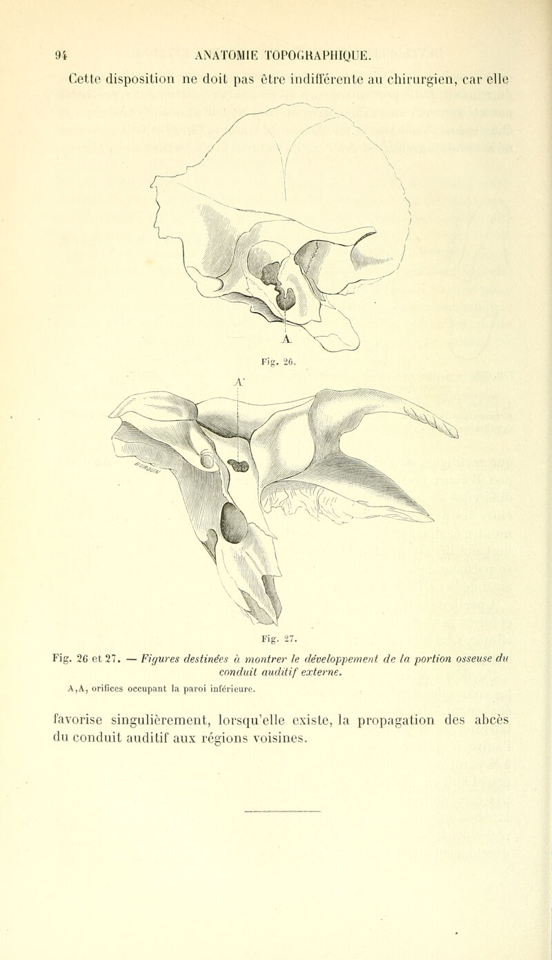 Cette disposition ne doit pas être indifférente au chirurgien, car elle t Fig. 26 et 27. — Figures destinées à montrer le développement de la portion osseuse du conduit auditif externe. A,A, orifices occupant la paroi inférieure. favorise singulièrement, lorscpa'elle existe, la propagation des abcès du conduit auditif aux régions voisines.