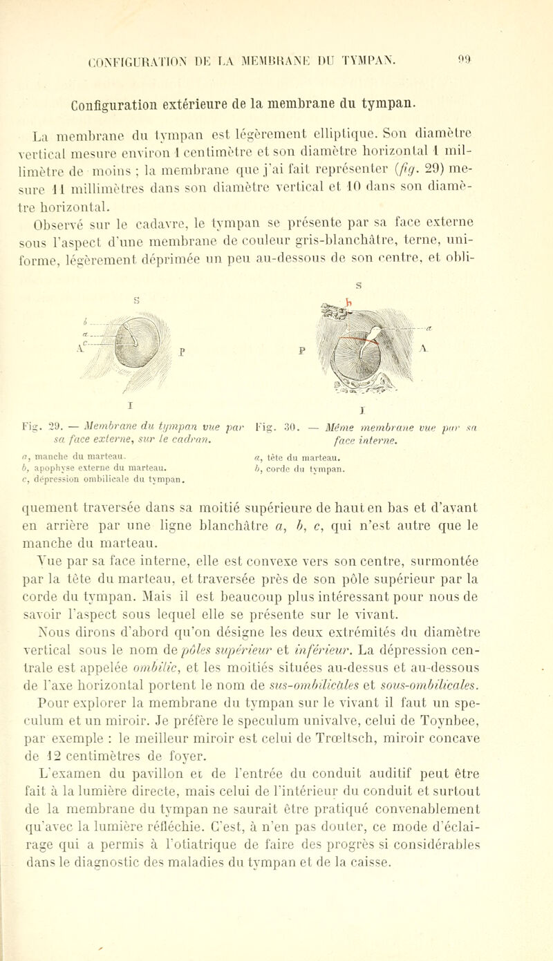 Configuration extérieure de la membrane du tympan. La membrane du tympan est légèrement elliptique. Son diamètre vertical mesure environ 1 centimètre et son diamètre horizontal 1 mil- limètre de moins ; la membrane que j'ai fait représenter {fig. 29) me- sure 11 millimètres dans son diamètre vertical et 10 dans son diamè- tre horizontal. Observé sur le cadavre, le tympan se présente par sa face externe sous l'aspect d'une membrane de couleur gris-blanchâtre, terne, uni- forme, légèrement déprimée un peu au-dessous de son centre, et obli- s _ y, 1 I Fig. 29. — Membrane du tympan vue par Fig. 30. — Même membrane vue pur sa sa face externe, sur le cadran. face interne. a, manche du marteau. a, tète du marteau. 6, apophyse externe du marteau. h, corde du tympan. e, dépression ombilicale du tympan. quement traversée dans sa moitié supérieure de haut en bas et d'ayant en arrière par une ligne blanchâtre a, b, c, qui n'est autre que le manche du marteau. Tue par sa face interne, elle est convexe vers son centre, surmontée par la tète du marteau, et traversée près de son pôle supérieur par la corde du tympan. Mais il est beaucoup plus intéressant pour nous de savoir l'aspect sous lequel elle se présente sur le vivant. Nous dirons d'abord qu'on désigne les deux extrémités du diamètre vertical sous le nom de pôles supérieur et inférieur. La dépression cen- trale est appelée ombilic, et les moitiés situées au-dessus et au-dessous de Taxe horizontal portent le nom de sus-ornbilicàles et sous-ombilicales. Pour explorer la membrane du tympan sur le vivant il faut un spé- culum et un miroir. Je préfère le spéculum univalve, celui de Toynbee, par exemple : le meilleur miroir est celui de Trœltsch, miroir concave de 12 centimètres de foyer. L'examen du pavillon et de l'entrée du conduit auditif peut être fait à la lumière directe, mais celui de l'intérieur du conduit et surtout de la membrane du tympan ne saurait être pratiqué convenablement qu'avec la lumière réfléchie. C'est, à n'en pas douter, ce mode d'éclai- rage qui a permis à Totiatrique de faire des progrès si considérables dans le diagnostic des maladies du tympan et de la caisse.