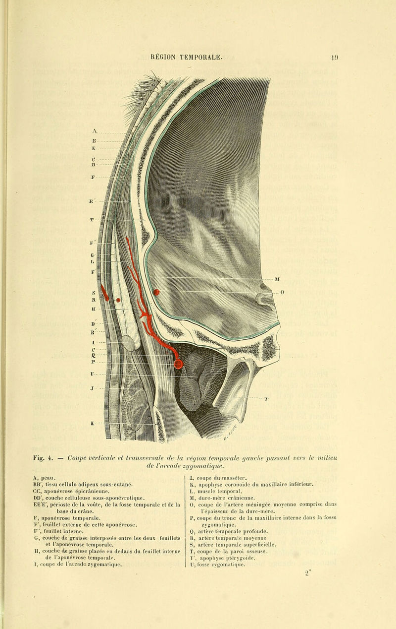 Fig. 4. — Coupe verticale et transversale de la région temporale gauche passant vers le milieu de l'arcade zygomatique. î, coupe du masséter. K, apophyse coroooïde du maxillaire inférieur. L, muscle temporal. M, dure-mère crânienne. 0, coupe de l'artère méningée moyenne comprise dans l'épaisseur de la dure-mère. P, coupe du tronc de la maxillaire interne dans la fosse zygomalique. Q, artère temporale profonde. H, artère temporale moyenne S, artère temporale superficielle. T, coupe de la paroi osseuse. T', apophyse ptérygoïde. U, fosse zvgomatique. 2* A, peau. BB', tissu cellulo adipeux sous-cutané. CC, aponévrose épicrânienne. DD', couche celluleuse sous-aponévrotique. EE'E', périoste de la voûte, de la fosse temporale et de la base du crâne. F, aponévrose temporale. F', feuillet externe de cette aponévrose. F, feuillet interne. G, couche de graisse interposée entre les deux feuillets et l'aponévrose temporale. U, couche de graisse placée en dedans du feuillet interne de l'aponévrose temporale. I, coupe de l'arcade zygomalique.