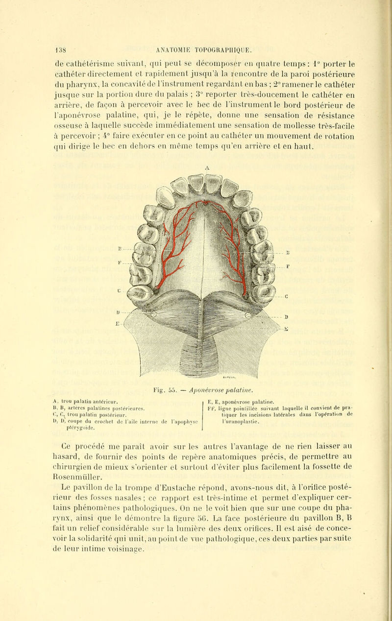 de cathétérisme suivant, qui peut se décomposer en quatre temps : 1° porter le cathéter directement et rapidement jusqu'à la rencontre de la paroi postérieure du pharynx, la concavité de l'instrument regardant en bas ; 2° ramener le cathéter jusque sur la portion dure du palais ; 3° reporter très-doucement le cathéter en arrière, de façon à percevoir avec le bec de l'instrument le bord postérieur de l'aponévrose palatine, qui, je le répète, donne une sensation de résistance osseuse à laquelle succède immédiatement une sensation de mollesse très-facile à percevoir ; -4° faire exécuter en ce point au cathéter un mouvement de rotation qui dirige le bec en dehors en même temps qu'en arrière et en haut. 0 $>! Fig. 55. — Aponévrose palatine. A, trou palatin antérieur. B, B, artères palatines postérieures. C, C^ trou palatin postérieur. 1), D, coupe du crochet de l'aile interne de l'apophyse ptérygoïde. E, E, aponévrose palatine. FF, ligne poinlillée suivant laquelle il convient de pra- tiquer les incisions latérales dans l'opération de l'uranoplastie. Ce procédé me paraît avoir sur les autres l'avantage de ne rien laisser au hasard, de fournir des points de repère anatomiques précis, de permettre au chirurgien de mieux s'orienter et surtout d'éviter plus facilement la fossette de Rosenmùller. Le pavillon de la trompe d'Eustache répond, avons-nous dit, à l'orifice posté- rieur des fosses nasales ; ce rapport est très-intime et permet d'expliquer cer- tains phénomènes pathologiques. On ne le voit bien que sur une coupe du pha- rynx, ainsi que le démontre la figure 56. La face postérieure du pavillon B, B fait un relief considérable sur la lumière des deux orifices. Il est aisé de conce- voir la solidarité qui unit, au point de vue pathologique, ces deux parties par suite de leur intime voisinage.