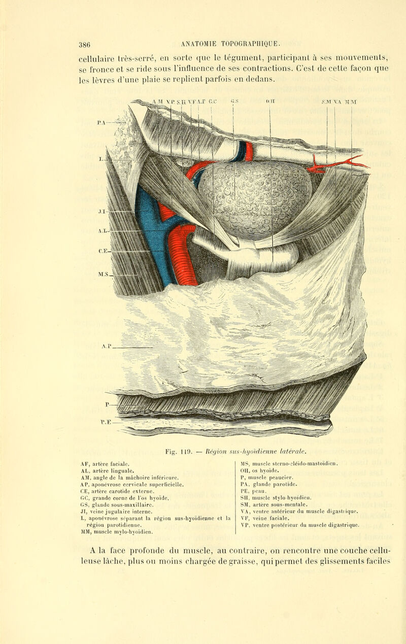 cellulaire très-serré, en sorte que le tégument, participant à ses mouvements, se fronce et se ride sous l'influence de ses contractions. C'est de cette façon que les lèvres d'une plaie se replient parfois en dedans. S.MVA M.M Fig. 119. — Région sus-hyoïdienne latérale. AF, artère faciale. AL, artère linguale. AM, angle de la mâchoire inférieure. AP, aponévrose cervicale superficielle. CE, artère carotide externe. OC, grande corne de Vos hyoïde. G8, glande sous-maxillaire. JI, veine jugulaire interne. L, aponévrose séparant la région sus-hyoïdienne et la région parotidienne. MM, muscle mylo-hyoïdien. MS, muscle sterno-eléido-mastoïdien. OH, os hyoïde. P, muscle peaucier. PA, glande parotide. PE, peau. SH, muscle stylo-hyoïdien. SM, artère sous-mentale. VA, ventre antérieur du muscle digastiique. VF, veine faciale. VP, ventre postérieur du muscle digastrique. A la face profonde du muscle, au contraire, on rencontre une couche cellu- leuse lâche, plus ou moins chargée dégraisse, qui permet des glissements faciles