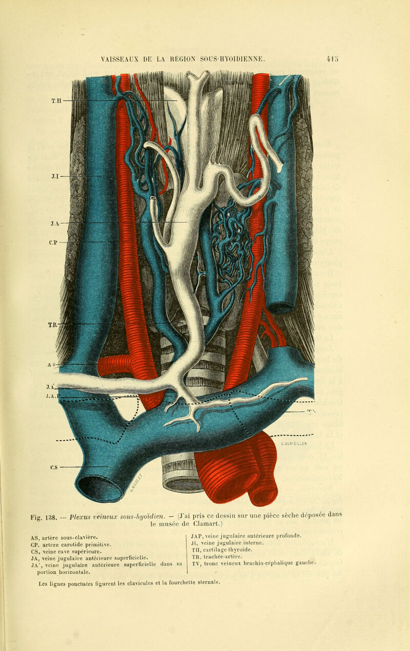 VAISSEAUX DE LA REGION SOUS-HYOIDIENNE. 41 o Fig. 138. — Plexus veineux sous-hijoïdien. - (J'ai pris ce dessin sur une pièce sèche déposée dans le musée de Clamart.) AS, artère sous-clavière. CP, artère carotide primitive. CS, -veine cave supérieure. JA, veine jugulaire antérieure superficielle. JA', veiDe jugulaire antérieure superficielle dans sa portion horizontale. JAP, veine jugulaire antérieure profonde. il, -veine jugulaire interne. TU, cartilage thyroïde. TR, trachée-artère. TV, tronc veineux brachiocéphalique gauche. Les ligues ponctuées figurent les clavicules et la fourchette sternale.