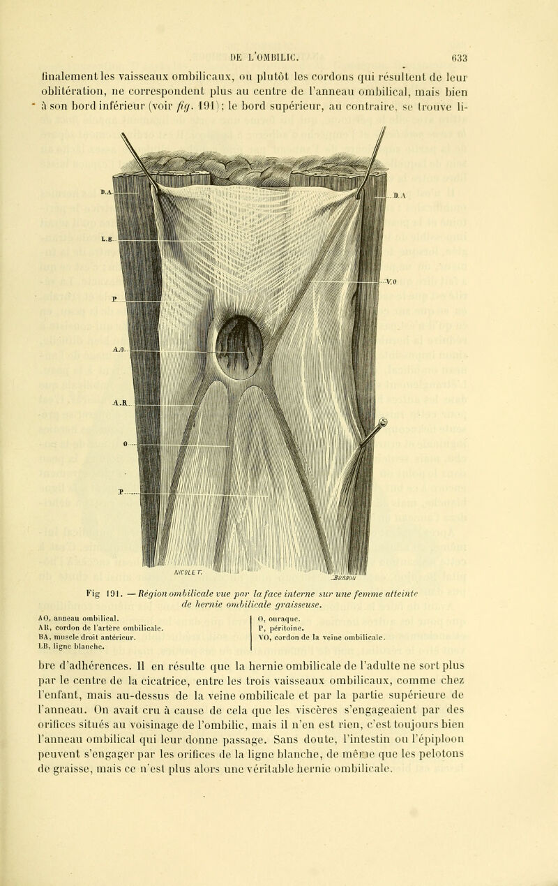 finalement les vaisseaux ombilicaux, ou plutôt les cordons qui résultent de leur oblitération, ne correspondent plus au centre de l'anneau ombilical, mais bien a son bord inférieur (voir fig. 191); le bord supérieur, au contraire, se trouve li- M- I J).A Fig 191. — Région ombilicale vue par la face interne sur une femme atteinte de hernie ombilicale graisseuse. AO, anneau ombilical. AU, cordon de l'artère ombilicale. BA, muscle droit antérieur. LB, ligne blanche. O, ouraque. P, péritoine. VO, cordon de la veine ombilicale. bre d'adhérences. Il en résulte que la hernie ombilicale de l'adulte ne sort plus par le centre de la cicatrice, entre les trois vaisseaux ombilicaux, comme chez l'enfant, mais au-dessus de la veine ombilicale et par la partie supérieure de l'anneau. On avait cru à cause de cela que les viscères s'engageaient par des orifices situés au voisinage de l'ombilic, mais il n'en est rien, c'est toujours bien l'anneau ombilical qui leur donne passage. Sans doute, l'intestin ou l'épiploon peuvent s'engager par les orifices de la ligne blanche, de même que les pelotons de graisse, mais ce n'est plus alors une véritable hernie ombilicale.