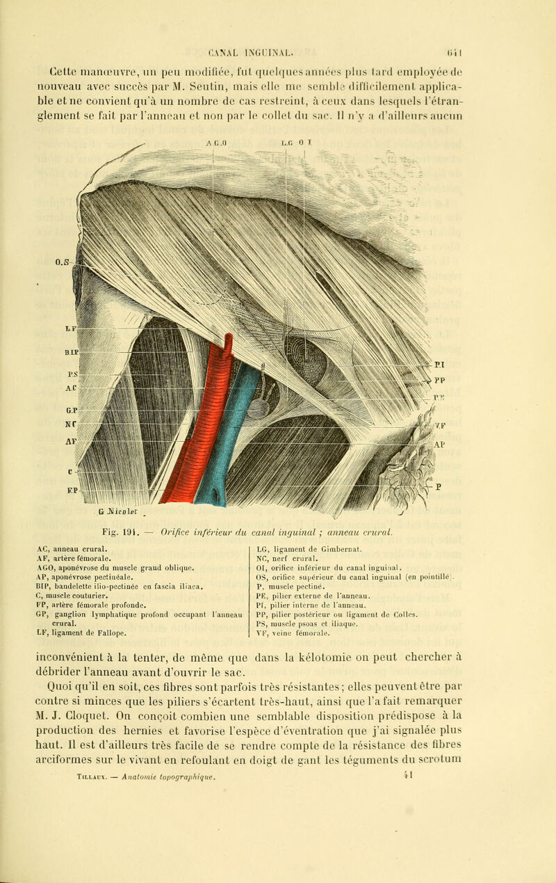 Cette manœuvre, un peu modifiée, fut quelques années plus tard employée de nouveau avec succès par M. Seutin, mais elle me semble difficilement applica- ble et ne convient qu'à un nombre de cas restreint, à ceux dans lesquels l'étran- glement se fait par l'anneau et non par le collet du sac. Il n'y a d'ailleurs aucun l.c o t o.s G JNieoleï Fig. 19 i. — Orifice inférieur du canal inguinal ; anneau crural. AC, anneau crural. AF, artère fémorale. AGO, aponévrose du muscle grand oblique. AP, aponévrose peetinéale. BIP, bandelette ilio-pectinée en fascia iliaea. C, muscle couturier. FP, artère fémorale profonde. GP, ganglion lymphatique profond occupant l'anneau crural. LF, ligament de Fallope. LG, ligament de Gimbernat. NC, nerf crural. 01, orifice inférieur du canal inguinal. OS, orifice supérieur du canal inguinal (en pointillé P, muscle pectine. PE, pilier externe de l'anneau. PI, pilier interne de l'anneau. PP, pilier postérieur ou ligament de Colles. PS, muscle psoas et iliaque. VF, veine fémorale. inconvénient à la tenter, de même que dans la kélotomie on peut chercher à débrider l'anneau avant d'ouvrir le sac. Quoi qu'il en soit, ces fibres sont parfois très résistantes ; elles peuvent être par contre si minces que les piliers s'écartent très-haut, ainsi que l'a fait remarquer M. J. Gioquet. On conçoit combien une semblable disposition prédispose à la production des hernies et favorise l'espèce d'éventration que j'ai signalée plus haut. Il est d'ailleurs très facile de se rendre compte de la résistance des fibres arciformes sur le vivant en refoulant en doigt de gant les téguments du scrotum Tillaux. — Anatomie topographique. *■
