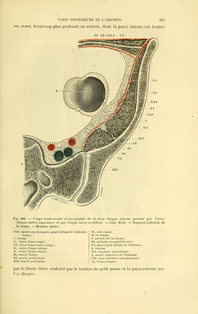 en avant, beaucoup plus profonde en arrière, dont la paroi interne est formée r.E P.O A.&.O T F.T Fig. 200. — Coupe transversale et horizontale de la fosse iliaque interne passant par l'épine iliaque antéro-supéricure et par l'angle sacro-vertébral. — Côté droit. — Segment inférieur de la coupe. — Homme adulte. AGO, aponévrose du muscle grand oblique de l'abdomen (rouge). C, cœcum. FI, fascia iliaca (rouge). FT, niscia transversales (rouge). IE, artère iliaque externe. H, artère iliaque interne. MI, muscle iliaque. MP, muscle grand psoas. MPP, muscle petit psoas. NC, nerf crural. 01, os iliaque. P, périoste de l'os iliaque. PE, péritoine (en pointillé uoir). PO, muscle petit oblique de l'abdomen. S, Sacrum. SSI, symphyse sacro-iliaque. T, muscle transverse de l'abdomen. TSP, tissu cellulaire sous-péritonéal. VI, Veines iliaques. par le fascia iliaca renforcé par le tendon du petit psoas et la paroi externe par l'os iliaque.