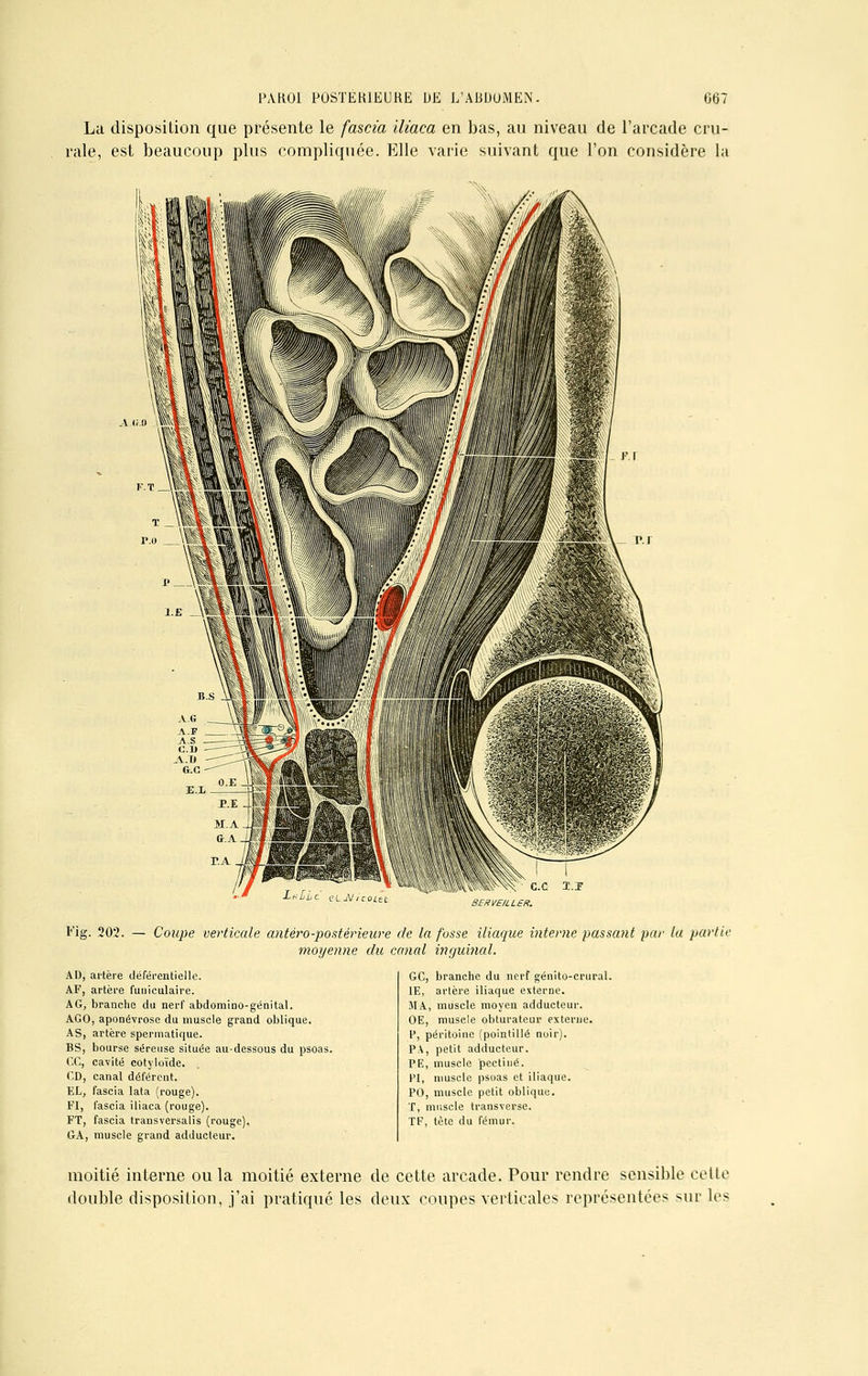 La disposition que présente le fascia iliaca en bas, au niveau de l'arcade cru- rale, est beaucoup plus compliquée. Elle varie suivant que l'on considère la a <;.o A Eig. 202. — Coupe verticale antéro-postérieure de la fusse iliaque interne passant par la partit moyenne du canal inguinal. AD, artère déférentielle. AF, artère funiculaire. A G, branche du nerf abdomino-génital. AGO, aponévrose du muscle grand oblique. AS, artère spermatique. BS, bourse séreuse située au-dessous du psoas. CC, cavité cotyloïde. CD, canal déférent. EL, fascia lata (rouge). FI, fascia iliaca (rouge). FT, fascia transversalis (rouge). GA, muscle grand adducteur. GC, branche du nerf génito-crural 1E, artère iliaque externe. MA, muscle moyen adducteur. OE, muscle obturateur externe. V, péritoine (pointillé noir). PA, petit adducteur. PE, muscle pectine. PI, muscle psoas et iliaque. PO, muscle petit oblique. T, muscle transverse. TF, tète du fémur. moitié interne ou la moitié externe de cette arcade. Pour rendre sensible cette double disposition, j'ai pratiqué les deux coupes verticales représentées sur les