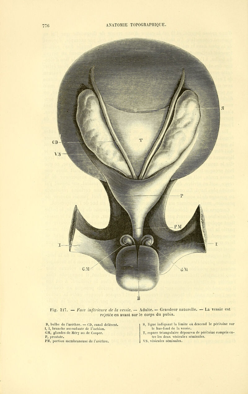 Fig. 217. — Face inférieure de la vessie. — Adulte. — Grandeur naturelle. — La vessie est rejetée en avant sur le corps du pubis. B, bulbe de l'urèthre. — CD, canal déférent. I, I, branche ascendante de l'ischion. GM, glandes de Méry ou de Cooper. P, prostate. P.YI, portion membraneuse de l'urèthre. S, ligne indiquant la limite où descend le péritoine sur le bas-fond de la vessie. T, espace triangulaire dépourvu de péritoine compris en- tre les deux -vésicules séminales. YS, vésicules séminales.