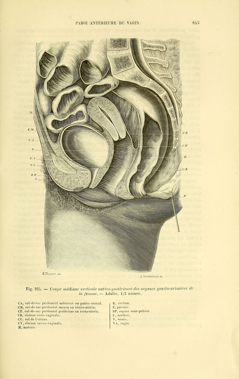 G.Nicolet del £. VCKMÛRCKEII, SC. Fig. 225. — Coupe médiane verticale antéro-postérieure des organes genito-urinaires de la femme. — Adulte, 1/2 nature. CA, cul-de-sac péritonéal antérieur ou pubio-vésical. CM, cul-de-sac péritonéal moyen ou vésico-utérin. CP, cul-de-sac péritonéal postérieur ou recto-utérin. CR, cloison recto-vaginale. CU, col de l'utérus. CV, cloison vésico-vaginale. M, matrice. R, rectum. P, périnée. SP, espace sous-pubien. U, urèthre. V, vessie. VA, vagin.