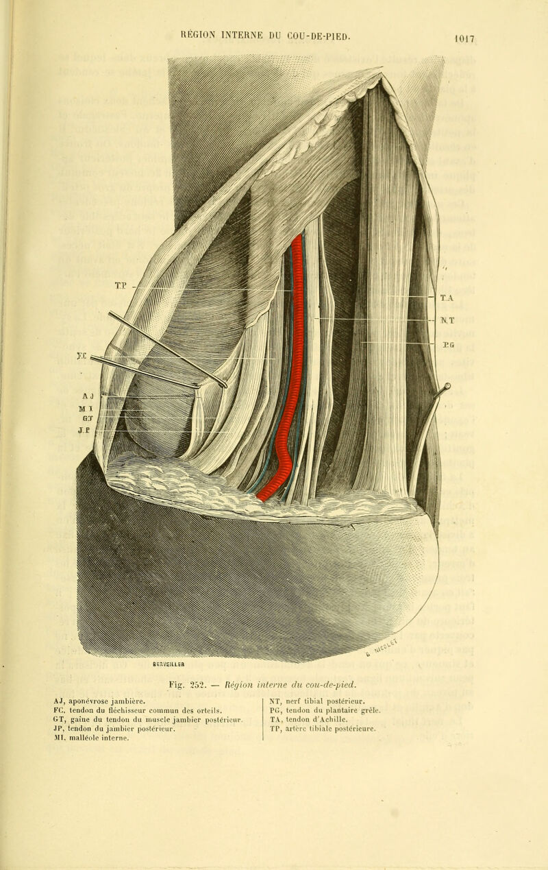 1017 Fig. 252. — Réghfi interne du cou-de-pied. AJ, aponévrose jambière. FC. tendon du fléchisseur commun des orteils. GT, gaine du tendon du muscle jambier postérieur. JP, tendon du jambier postérieur. MI, malléole interne. NT, nerf tibial postérieur. PG, tendon du plantaire grêle. TA, tendon d'Achille. TP, artère tibiale postérieure.