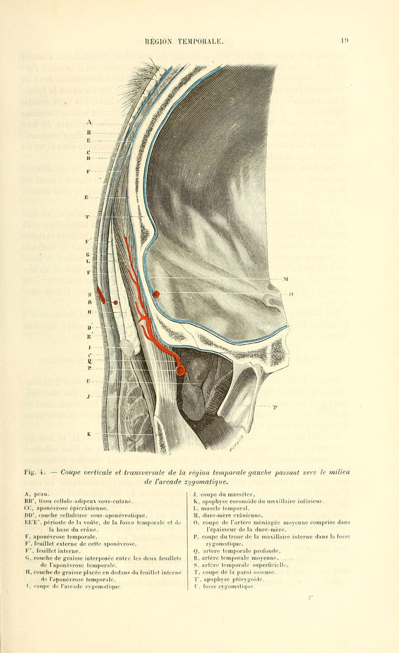 Fig. 4. — Coupe verticale et transversale de la région temporale gauche passant vers le milieu de l'arcade zygomatique. A, peau. BB', tissu cellulo-adipeux sous-cutané, ce, aponévrose épicrânienne. DD', couche cellulouse sous-aponévrotique. EE'E, périoste de la voûte, de la fosse temporale et de la base du crâne. F, aponévrose temporale. F', feuillet externe de cette aponévrose. F, feuillet interne. G, couche de graisse interposée entre les deux feuillets de l'aponévrose temporale. H, couche de graisse placée en dedans du feuillet interne de l'aponévrose temporale. 1, coupe de l'arcade zygomatique. J, coupe du masséter. K, apophyse coronoïde du maxillaire inférieur. L, muscle temporal. M, dure-mère crânienne. 0, coupe de l'artère méningée moyenne comprise dans l'épaisseur de la dure-mère. P, coupe du tronc de la maxillaire interne dans la fosse zygomatique. Q, artère temporale profonde. R, artère temporale moyenne. S, artère temporale superficielle, ï, coupe de la paroi osseuse. T', apophyse ptérygoïdc. r, fosse zygomatique.