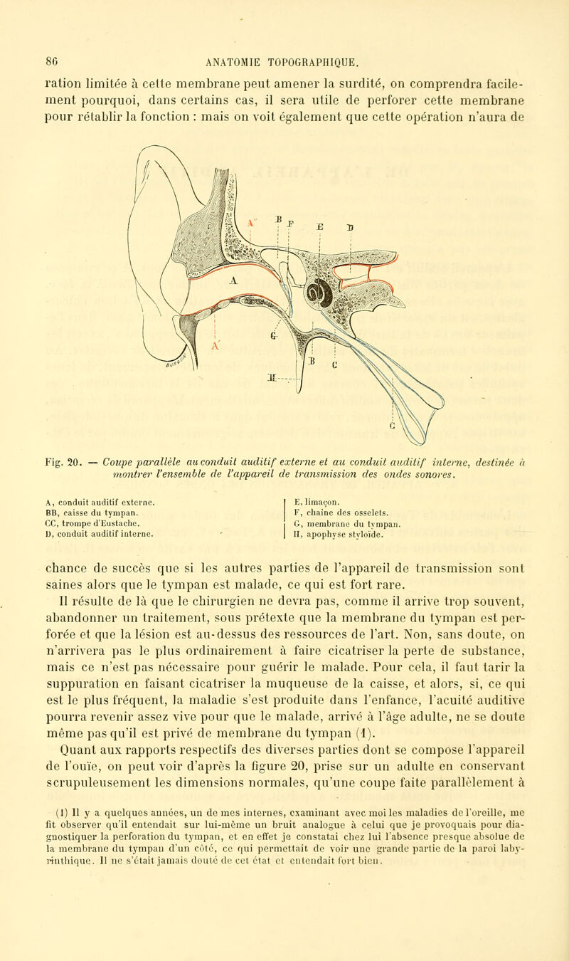 ration limitée à cette membrane peut amener la surdité, on comprendra facile- ment pourquoi, dans certains cas, il sera utile de perforer cette membrane pour rétablir la fonction : mais on voit également que cette opération n'aura de Fig. 20. — Coupe 2)arallèle au conduit auditif externe et au conduit auditif interne, destiyiée à montrer l'ensemble de l'appareil de traJismissioJi des ondes sonores. A, conduit auditif externe. BB, caisse du tympan, ce, trompe d'Eustaclie. 1). conduit auditif interne. E, limaçon. F, chaîne des osselets. G, membrane du tympan. H, apophyse styloïde. cbance de succès que si les autres parties de l'appareil de transmission sont saines alors que le tympan est malade, ce qui est fort rare. Il résulte de là que le chirurgien ne devra pas, comme il arrive trop souvent, abandonner un traitement, sous prétexte que la membrane du tympan est per- forée et que la lésion est au-dessus des ressources de l'art. Non, sans doute, on n'arrivera pas le plus ordinairement à faire cicatriser la perte de substance, mais ce n'est pas nécessaire pour guérir le malade. Pour cela, il faut tarir la suppuration en faisant cicatriser la muqueuse de la caisse, et alors, si, ce qui est le plus fréquent, la maladie s'est produite dans l'enfance, l'acuité auditive pourra revenir assez vive pour que le malade, arrivé à l'âge adulte, ne se doute même pas qu'il est privé de membrane du tympan (1). Quant aux rapports respectifs des diverses parties dont se compose l'appareil de l'ouïe, on peut voir d'après la figure 20, prise sur un adulte en conservant scrupuleusement les dimensions normales, qu'une coupe faite parallèlement à (1) Il y a quelques aunces, un de mes internes, examinant avec moi les maladies de Toreille, me fit observer qu'il entendait sur lui-même un bruit analogue à celui que je provoquais pour dia- gnostiquer la perforation du tympan, et en effet je constatai cliez lui l'absence presque absolue de la membrane du tympan d'un côte, ce qui permettait de voir une grande partie de la paroi laby- mitbiquc. Il ne s'était jamais douté de cet état et entendait fort bien.