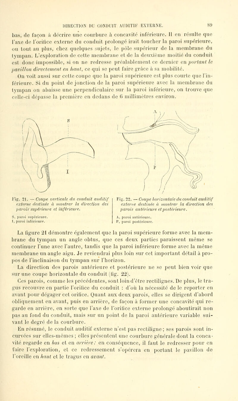 bas, de façon à décrire une courbure à concavité inférieure. 11 en résulte que l'axe de l'orifice externe du conduit prolongé irait toucber la paroi supérieure, ou tout au plus, cbez quelques sujets, le pôle supérieur de la membrane du tympan. L'exploration de cette membrane et de la deuxième moitié du conduit est donc impossible, si on ne redresse préalablement ce dernier en portant le pavillon directement en haut, ce qui se peut faire grâce à sa mobilité. On voit aussi sur cette coupe que la paroi supérieure est plus courte que l'in- férieure. Si du point de jonction de la paroi supérieure avec la membrane du tympan on abaisse une perpendiculaire sur la paroi inférieure, on trouve que celle-ci dépasse la première en dedans de 6 millimètres environ. Fig. 21. — Coupe verticale du conduit auditif externe destinée à montrer la direction des parois supériewe et inférieure. S, paroi supérieure. I, paroi inférieure. Fig. 22. — Coupe horizo7itale du conduit auditif externe destinée à montrer la direction des parois aiitérieure et postérieure. A, paroi antérieure. P, paroi postérieure. La figure 21 démontre également que la paroi supérieure forme avec la mem- brane du tympan un angle obtus, que ces deux parties paraissent même se continuer l'une avec l'autre, tandis que la paroi inférieure forme avec la même membrane un angle aigu. Je reviendrai plus loin sur cet important détail à pro- pos de l'inclinaison du tympan sur l'borizon. La direction des parois antérieure et postérieure ne se peut bien voir que sur une coupe horizontale du conduit (fig. 22). Ces parois, comme les précédentes, sont loin d'être rectilignes. De plus, le tra- gus recouvre en partie l'orifice du conduit : d'oi^i la nécessité de le reporter en avant pour dég^ager cet orifice. Quant aux deux parois, elles se dirigent d'abord obliquement en avant, puis en arrière, de façon à former une concavité qui re- garde en arrière, en sorte que l'axe de l'orifice externe prolongé aboutirait non pas au fond du conduit, mais sur un point de la paroi antérieure variable sui- vant le degré de la courbure. En résumé, le conduit auditif externe n'est pas rectiligne ; ses parois sont in- curvées sur elles-mêmes ; elles présentent une courbure générale dont la conca- vité regarde en bas et en arrière: en conséquence, il faut le redresser pour en faire l'exploration, et ce redressement s'opérera en portant le pavillon de l'oreille en haut et le tragus en avant.