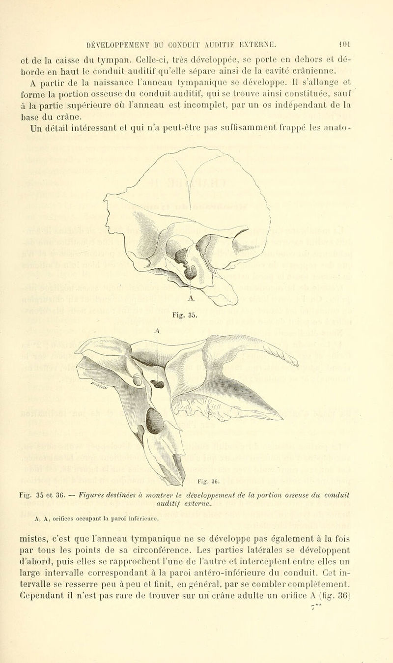 et de la caisse du tympan. Celle-ci, très développée, se porte en dehors et dé- borde en haut le conduit auditif qu'elle sépare ainsi de la cavité crânienne. A partir de la naissance l'anneau tympanique se développe. Il s'allonge et forme la portion osseuse du conduit auditif, qui se trouve ainsi constituée, sauf à la partie supérieure où l'anneau est incomplet, par un os indépendant de la base du crâne. Un détail intéressant et qui n'a peut-être pas suffisamment frappé les anato- Fiff. 36. Fig. 35 et 36. — Figures destinées à moiitrer le développement de la po7'tio7i osseuse du conduit auditif externe.. A, A, orifices occupant la paroi inférieure. mistes, c'est que l'anneau tympanique ne se développe pas également à la fois par tous les points de sa circonférence. Les parties latérales se développent d'abord, puis elles se rapprochent l'une de l'autre et interceptent entre elles un large intervalle correspondant à la paroi antéro-inférieure du conduit. Cet in- tervalle se resserre peu àpeu et finit, en général, par se combler complètement. Cependant il n'est pas rare de trouver sur un crâne adulte un orifice A (fig. 36)