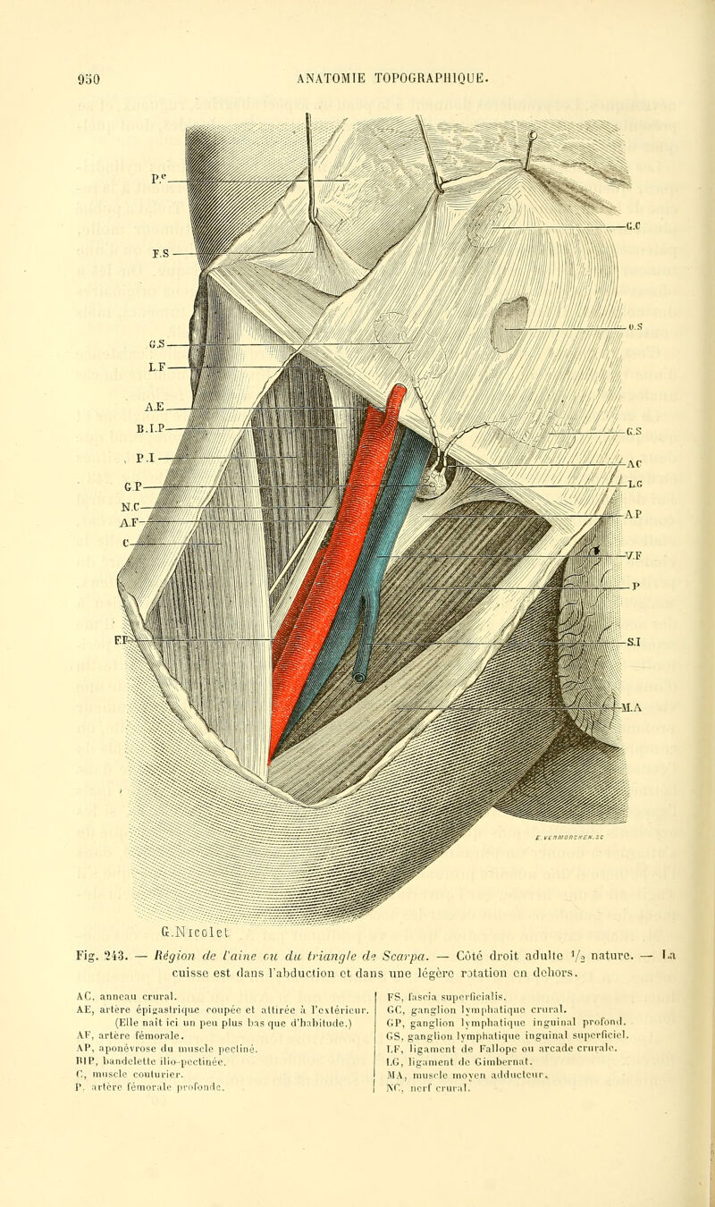 G.i,icclc Fig. '243. — Régioji de l'aine eu du triangle d? Scarpa. — Côté droit adulte '/^ nature, cuisse est dans l'abduction et dans une légère rotation en dehors. — I.a AC, anneau crural. AE, artère épigastri(|u.e roupéc et attirée à l'cxtérionr. (Elle naît ici un peu plus bas cpie d'habitude.) AF, artère fémorale. AP, aponévrose du muscle pectine. lilP, liandclette ilio-pectinée. C, muscle couturier. P- artère fémorale profonde. FS, fascia superfieialis. GC, ganglion lymphatique crural. GP, ganglion lymphatique inguinal profond. GS. ganglion lymphatique inguinal superficiel. 1,F, ligament de Fallopc ou arcade crurale. LG, ligament do Gimbernat. MA, muselé moyen adducteur. KG, nerf crural.