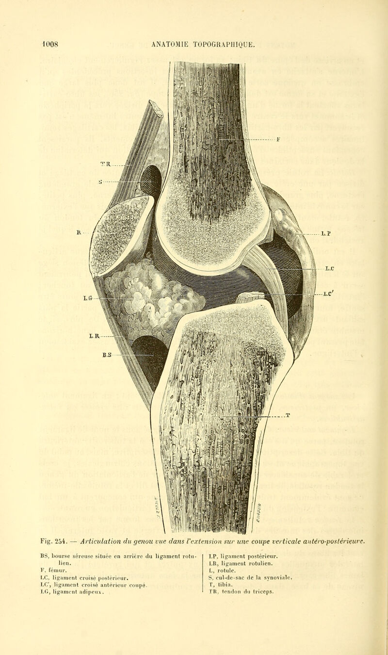 I l.P Fig. 254. — Articulation du genou vue dans l'extension sur une coupe verticale antéro-postérieure. BS, bourse séreuse située en arrière du ligament rotu- lien. F, fémur. LC, ligament croisé postérieur. LC, ligament croisé antérieur coupé. LG, ligament adipeux. LP, ligament postérieur. LR, ligament rotulien. L, rotule. S, cul-de-sac de la synoviale. T, tibia. TR, tendon du triceps.