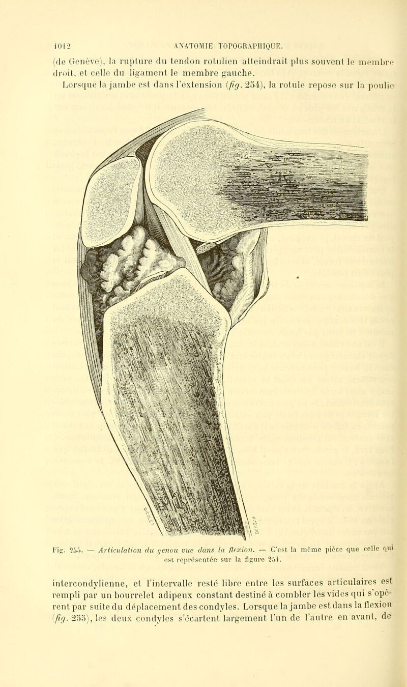 (de (ionève), la rupture du tendon rotulien atteindrait plus souvent le nienihrc droit, et celle du ligament le membre gauche. Lorsque la jambe est dans l'extension [fîg. 254), la rotule repose sur la poulie Fis- ^ôf). — Articulation du genou vue dans la flexion. — C'est la même picco que celle qui est représentée sur la figure 25i. intercondylienne, et l'intervalle resté libre entre les surfaces articulaires est rempli par un bourrelet adipeux constant destiné à combler les vides qui s opè- rent par suite du déplacement des condyles. Lorsquela jambe est dans la flexion ifig. 25o), les deux condyles s'écartent largement l'un de Vautre en avant, de