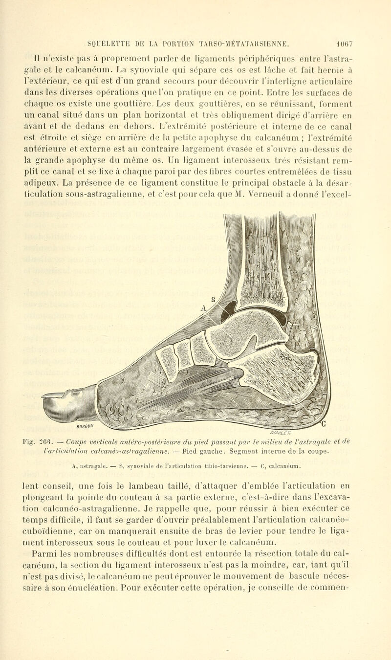 II n'existe pas à proprement parler de ligaments périphériques entre l'astra- gale et le calcanéum. La synoviale qui sépare ces os est lâche et fait hernie à l'extérieur, ce qui est d'un grand secours pour découvrir l'interligne articulaire dans les diverses opérations que l'on pratique en ce point. Entre les surfaces de chaque os existe une gouttière. Les deux gouttières, en se réunissant, forment un canal situé dans un plan horizontal et très obliquement dirigé d'arrière en avant et de dedans en dehors. L'extrémité postérieure et interne de ce canal est étroite et siège en arrière de la petite apophyse du calcanéum ; l'extrémité antérieure et externe est au contraire largement évasée et s'ouvre au-dessus de la grande apophyse du même os. Un ligament interosseux très résistant rem- plit ce canal et se fixe à chaque paroi par des fibres courtes entremêlées de tissu adipeux. La présence de ce ligament constitue le principal obstacle à la désar- ticulation sous-astragalienne, et c'est pour cela que M. Verneuil adonné l'excel- Fig. 205. — Coupe verticale aniérc-postérieure du pied passant par le milieu de l'astragale et de l'articulation calcanéo-aslragalienne, —Pied gauche. Segment interne de la coupe. A, astragale. — S, synoviale de l'articulation tibio-tarsienne. ■— G, calcanéum. lent conseil, une fois le lambeau taillé, d'attaquer d'emblée l'articulation en plongeant la pointe du couteau à sa partie externe, c'est-à-dire dans l'excava- tion calcanéo-astragalienne. Je rappelle que, pour réussir à bien exécuter ce temps difficile, il faut se garder d'ouvrir préalablement l'articulation calcanéo- cubo'idienne, car on manquerait ensuite de bras de levier pour tendre le liga- ment interosseux sous le couteau et pour luxer le calcanéum. Parmi les nombreuses difficultés dont est entourée la résection totale du cal- canéum, la section du ligament interosseux n'est pas la moindre, car, tant qu'il n'est pas divisé, le calcanéum ne peut éprouver le mouvement de bascule néces- saire à son énucléation. Pour exécuter cette opération, je conseille de commen-