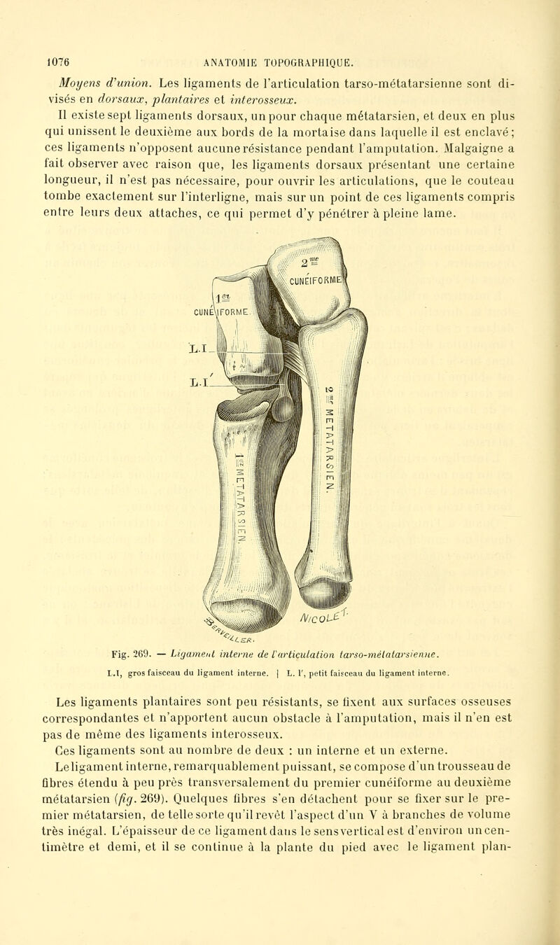 Moyens d'union. Les ligaments de l'articulation tarso-métatarsienne sont di- visés en dorsaux, plantaires et interosseux. Il existe sept ligaments dorsaux, un pour chaque métatarsien, et deux en plus qui unissent le deuxième aux bords de la mortaise dans laquelle il est enclavé; ces ligaments n'opposent aucune résistance pendant l'amputation. Malgaigne a fait observer avec raison que, les ligaments dorsaux présentant une certaine longueur, il n'est pas nécessaire, pour ouvrir les articulations, que le couteau tombe exactement sur l'interligne, mais sur un point de ces ligaments compris entre leurs deux attaches, ce qui permet d'y pénétrer à pleine lame. Fig. 269. — Ligament mtonie de iarticulation tarso-métatarsienne. L.I, gros faisceau du ligament interne. | L. T, petit faisceau du ligament interne. Les ligaments plantaires sont peu résistants, se lixent aux surfaces osseuses correspondantes et n'apportent aucun obstacle à l'amputation, mais il n'en est pas de même des ligaments interosseux. Ces ligaments sont au nombre de deux : un interne et un externe. Leligament interne, remarquablement puissant, se compose d'un trousseau de fibres étendu à peu près transversalement du premier cunéiforme au deuxième métatarsien {fig. 269). Quelques libres s'en détachent pour se fixer sur le pre- mier métatarsien, de telle sorte qu'il revêt l'aspect d'un V à branches de volume très inégal. L'épaisseur de ce ligament dans le sens vertical est d'environ un cen- timètre et demi, et il se continue à la plante du pied avec le ligament plan-