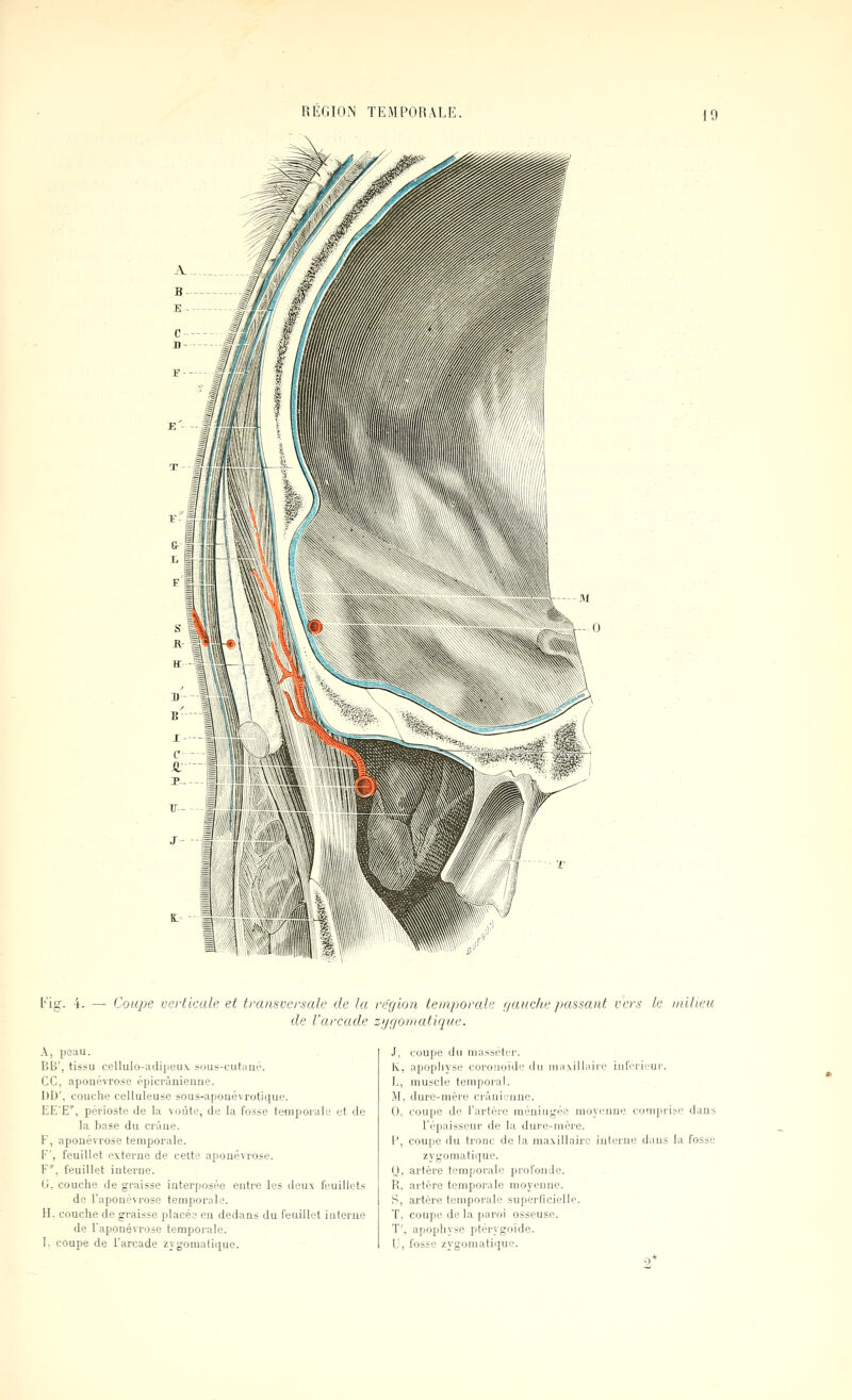 l'ig. -i. — Coupe verticale et transversale de la re'gion temporal':: f/auche j/assant vers le milieu de l'arcade zygornatique. A, peau. BB', tissu ceUulo-;idi[jeu\ sous-cutani!'. ce, aponévrose épicrânienne. 1)D', couche celluleuse sous-aponévrotique. EE'E, périoste de la voûte, de la fosse temporulL- et de la base du crâue. F, aponévrose temporale. F', feuillet px:terne de cette aponévrose. F, feuillet interne. G. couche de graisse interposée entre les deux feuillets de l'aponévrose temporak'. H. couche de graisse placés eu dedans du feuillet interne de laponévrose temporale. I. coupe de l'arcade zygomatique. coupe du niassetei'. apophyse coronoïdc du ]n;i\ill;\iLi' iiifcrii-ur. muscle temporal. dure-mère crânienne. coupe de l'artère méningée moyenne cuniprise dans l'épaisseur de la dure-mère, coupe du tronc de la maxillaire inlm-ne dans la fosse zygomatique. artère temporale profonde, artère temporale moyenne, artère temporale superficielle, coupe de la paroi osseuse, apophyse ptérygoïde. fosse zvgomatii]ue. 5*