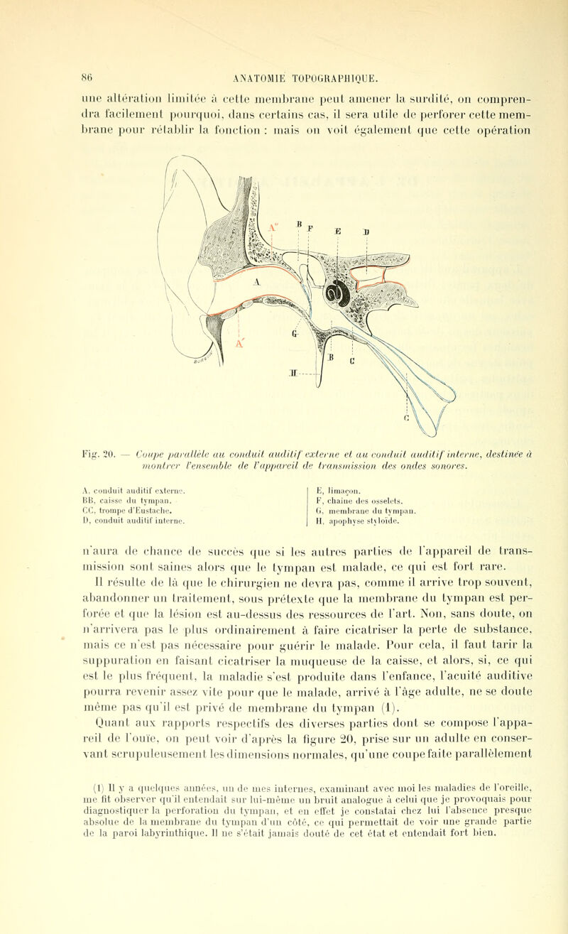une aUéi'ation limitée à cette meni])i'aiie peut amener la surdité, on compren- dra facilement pourquoi, dans certains cas, il sera utile de perforer cette mem- ])rane pour rétablir la fonction : mais on voit également que cette opération Fig. 20. — Cuupe parallèle au conduit audilif externe et au conduit auditif interne, destinée à montrer l'ensemble de l'appareil de transmission des ondes sonores. A. conduit auditif externe. BB, caisse du tympan, ce, trompe d'Eustaclie. D, conduit auditif interne. E, limaçon. F, chaîne des osselets. G, membrane du tympan. H, apophyse stjloïde. n'aura de chance de succès que si les autres parties de l'appareil de trans- mission sont saines alors que le tympan est malade, ce qui est fort rare. 11 résulte de là que le chirurgien ne devra pas, comme il arrive trop souvent, abandonner un traitement, sous prétexte que la membrane du tympan est per- forée et que la lésion est au-dessus des ressources de l'art. Non, sans doute, on n'arrivera pas le plus ordinairement à faire cicatriser la perte de substance, mais ce n'est pas nécessaire pour guérir le malade. Pour cela, il faut tarir la suppuration en faisant cicatriser la muqueuse de la caisse, et alors, si, ce qui est le plus fréquent, la maladie s'est produite dans l'enfance, l'acuité auditive pourra revenir assez vite pour que le malade, arrivé à l'âge adulte, ne se doute même pas qu'il est privé de membrane du tympan (1). Quant aux rapports respectifs des diverses parties dont se compose l'appa- reil de l'ouïe, on peut voir d'après la figure 20, prise sur un adulte en conser- vant scrupuleusement les dimensions normales, qu'une coupe faite parallèlement (1) Il y a quelques aunées, un de mes iuterues, cxauiiuaut avec moi les maladies de l'oreille, me fit observer qu'il entendait sur lui-même uu bruit analogue à celui que je provoquais pour diagnostiquer la perforation du tympan, et en effet je constatai chez lui l'absence presque absolue de la membrane du tympan d'un côté, ce qui permettait de voir une grande partie de la paroi labyrinthique. 11 ne s'était jamais douté de cet état et entendait fort bien.