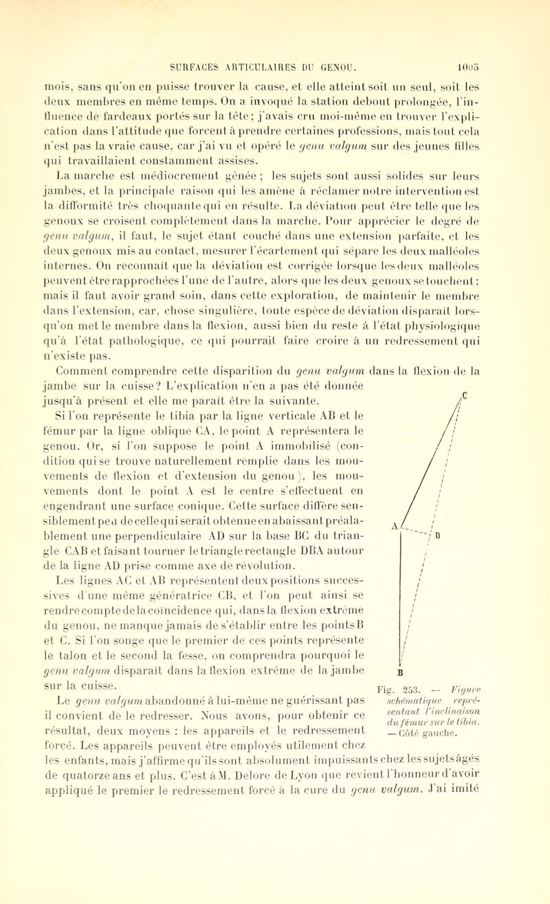 mois, sans qu'on en puisse trouver la cause, et elle atteint soit un seul, soit les deux membres en même temps. On a invoqué la station debout prolongée, Fin- tluence de fardeaux portés sur la tète; j'avais ci'u moi-même en trouver l'expli- cation dans l'attitude que forcent à prendre certaines professions, mais tout cela n'est pas la vraie cause, car j'ai vu et opéré le genu vnlgum sur des jeunes filles qui travaillaient constamment assises. La marche est médiocrement gênée ; les sujets sont aussi solides sur leurs jambes, et la principale raison qui les amène à réclamer notre intervention est la difformité très choquante qui en résulte. La déviation peut être telle que les genoux se croisent complètement dans la marche. Pour apprécier le degré de genu valgum, il faut, le sujet étant couché dans une extension parfaite, et les deux genoux mis au contact, mesurer l'écartement qui sépare les deux malléoles internes. On reconnaît que la déviation est corrigée lorsque les deux malléoles peuvent être rapprochées l'une de l'autre, alors que les deux genoux se touchent: mais il faut avoir grand soin, dans cette exploration, de maintenir le membre dans l'extension, car, chose singulière, toute espèce de déviation disparait lors- qu'on met le membre dans la flexion, aussi bien du reste à l'état physiologique qu'à l'état pathologique, ce qui pourrait faire croire à un redressement qui n'existe pas. Comment comprendre cette disparition du genu valgum dans la flexion de la jambe sur la cuisse? L'explication n'en a pas été donnée jusqu'à présent et elle me parait être la suivante. Si l'on représente le tibia par la ligne verticale AB et le fémur par la ligne oblique CA, le point A représentera le genou. Or, si l'on suppose le point A immobilisé (con- dition qui se trouve naturellement remplie dans les mou- vements de flexion et d'extension du genou), les mou- vements dont le point A est le centre s'eft'ectuent en engendrant une surface conique. Cette surface diffère sen- siblement peu de celle qui serait obtenue en abaissant préala- blement une perpendiculaire AD sur la base BC du trian- gle CAB et faisant tourner le triangle rectangle DBA autour de la ligne AD prise comme axe de révolution. Les lignes AC et AB représentent deux positions succes- sives d'une même génératrice CB, et l'on peut ainsi se rendre compte de la coïncidence qui, dans la flexion extrême du genou, ne manque jamais de s'établir entre les points B et C. Si l'on songe que le premier de ces points représente le talon et le second la fesse, on comprendra pourquoi le genu valgum disparaît dans la flexion extrême de la jambe sur la cuisse. Le genu valgum abandonné à lui-même ne guérissant pas il convient de le redresser. Nous avons, pour obtenir ce résultat, deux moyens : les appareils et le redressement forcé. Les appareils peuvent être employés utilement chez les enfants, mais j'affirme qu'ils sont absolument impuissants cbez les sujetsâgés de quatorze ans et plus. C'est à M. Delore de Lyon que revient l'honneur d'avoir appliqué le premier le redressement forcé à la cure du genu valgum. J'ai imité A^_ Fig. 253. — Figure, schématique repré- sentant l'Inclinaison du fémur sur le tibia. — Côté gauche.