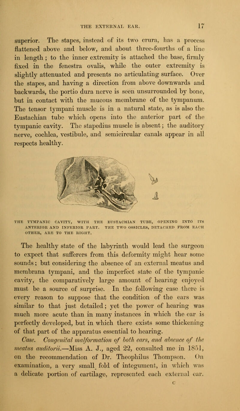 superior. The stapes, instead of its two crura, lias a process flattened above and below, and about three-fourths of a line in length ; to the inner extremity is attached the base, firmly fixed in the fenestra ovalis, while the outer extremity is slightly attenuated and presents no articulating surface. Over the stapes, and having a direction from above downwards and backwards, the portio dura nerve is seen unsurrounded by bone, but in contact with the mucous membrane of the tympanum. The tensor tympani muscle is in a natural state, as is also the Eustachian tube which opens into the anterior part of the tjrmpanic cavity. The stapedius muscle is absent; the auditory nerve, cochlea, vestibule, and semicircular canals appear in all respects healthy. 1 THE TYMPANIC CAVITY, WITH THE EUSTACHIAN TUBE, OPENING INTO ITS ANTERIOR AND INFERIOR PART. THE TWO OSSICLES, DETACHED FROM EACH OTHER, ARE TO THE RIGHT. The healthy state of the labyrinth would lead the surgeon to expect that sufferers from this deformity might hear some sounds; but considering the absence of an external meatus and membrana tympani, and the imperfect state of the tympanic cavity, the comparatively large amount of hearing enjoyed must be a source of surprise. In the following case there is every reason to suppose that the condition of the ears was similar to that just detailed; yet the power of hearing was much more acute than in many instances in which the ear is perfectly developed, but in which there exists some thickening of that part of the apparatus essential to hearing. Case. Congenital malformation of both ears, and absence of the meatus auditorii.—Miss A. J., aged 22, consulted me in 1851, on the recommendation of Dr. Theophilus Thompson. (hi examination, a very small fold of integument, in which was a delicate portion of cartilage, represented each external ear. c