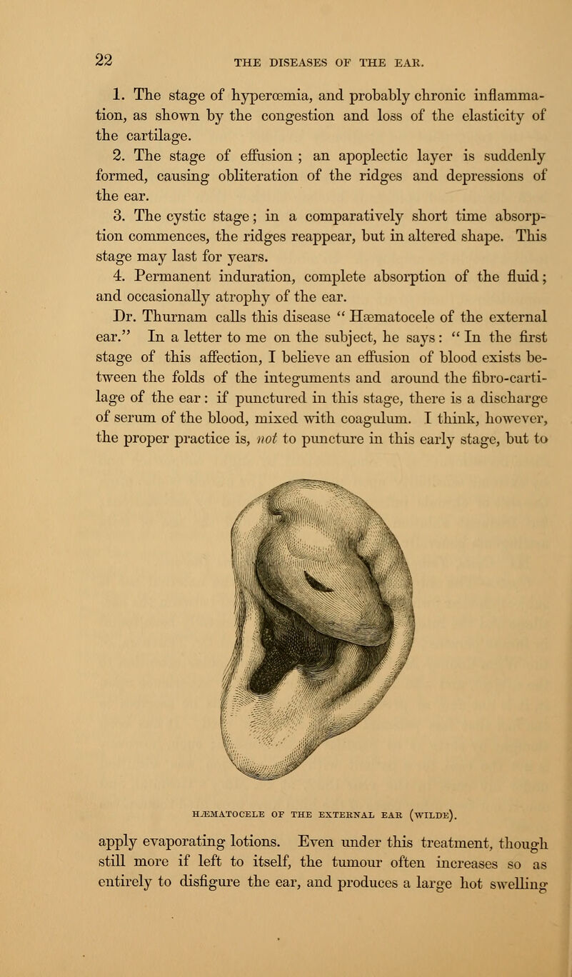 1. The stage of hyperoemia, and probably chronic inflamma- tion, as shown by the congestion and loss of the elasticity of the cartilage. 2. The stage of effusion ; an apoplectic layer is suddenly formed, causing obliteration of the ridges and depressions of the ear. 3. The cystic stage; in a comparatively short time absorp- tion commences, the ridges reappear, but in altered shape. This stage may last for years. 4. Permanent induration, complete absorption of the fluid; and occasionally atrophy of the ear. Dr. Thurnam calls this disease  Hematocele of the external ear. In a letter to me on the subject, he says:  In the first stage of this affection, I believe an effusion of blood exists be- tween the folds of the integuments and around the fibro-carti- lage of the ear: if punctured in this stage, there is a discharge of serum of the blood, mixed with coagulum. I think, however, the proper practice is, not to puncture in this early stage, but to HEMATOCELE OF THE EXTERNAL EAR (wILBe). apply evaporating lotions. Even under this treatment, though still more if left to itself, the tumour often increases so as entirely to disfigure the ear, and produces a large hot swellino-