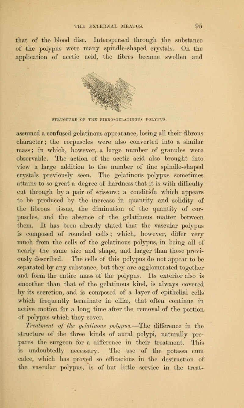 that of the blood disc. Interspersed through the substance of the polypus were many spindle-shaped crystals. On the application of acetic acid, the fibres became swollen and STltUCTUIlE OF THE FIBRO-GELATINOUS POLYPUS. assumed a confused gelatinous appearance, losing all their fibrous character; the corpuscles were also converted into a similar mass; in which, however, a large number of granules were observable. The action of the acetic acid also brought into view a large addition to the number of fine spindle-shaped crystals previously seen. The gelatinous polypus sometimes attains to so great a degree of hardness that it is with difficulty cut through by a pair of scissors; a conditidn which appears to be produced by the increase in quantity and solidity of the fibrous tissue, the diminution of the quantity of cor- puscles, and the absence of the gelatinous matter between them. It has been already stated that the vascular polypus is composed of rounded cells; which, however, differ very much from the cells of the gelatinous polypus, in being all of nearly the same size and shape, and larger than those previ- ously described. The cells of this polypus do not appear to be separated by any substance, but they are agglomerated together and form the entire mass of the polypus. Its exterior also is smoother than that of the gelatinous kind, is always covered by its secretion, and is composed of a layer of epithelial cells which frequently terminate in cilise, that often continue in active motion for a long time after the removal of the portion of polypus which they cover. Treatment of the gelatinous polypus.—The difference in the structure of the three kinds of aural polypi, naturally pre- pares the surgeon for a difference in their treatment. This is undoubtedly necessary. The use of the potassa cum calce, which has proved so efficacious in the destruction of the vascular polypus, is of but little service in the treat-