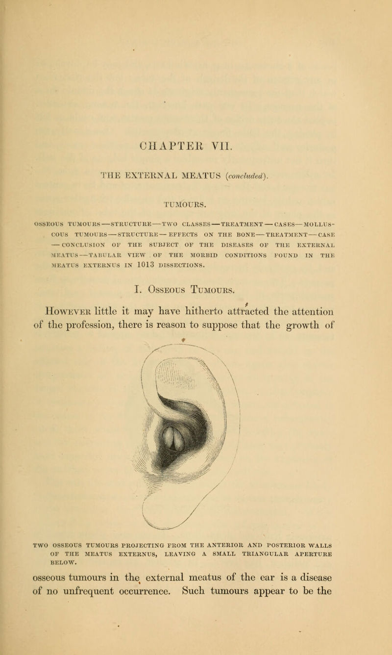 CHAPTEK VII. THE EXTERNAL MEATUS {concluded). TUMOURS. OSSEOUS TUMOURS—STRUCTURE — TWO CLASSES — TREATMENT — CASES—MOLLUS- COUS TUMOURS STRUCTURE—EFFECTS ON THE BONE TREATMENT CASE CONCLUSION OF THE SUBJECT OF THE DISEASES OF THE EXTERNAL MEATUS—TABULAR VIEW OF THE MORBID CONDITIONS FOUND IN THE MEATUS EXTERNUS IN 1013 DISSECTIONS. I. Osseous Tumours. However little it may have hitherto attracted the attention of the profession, there is reason to suppose that the growth of 1 .1. X TWO OSSEOUS TUMOURS PROJECTING FROM THE ANTERIOR AND POSTERIOR WALLS OF THE MEATUS EXTERNUS, LEAVING A SMALL TRIANGULAR APERTURE BELOW. osseous tumours in the external meatus of the ear is a disease « of no unfrequent occurrence. Such tumours appear to be the