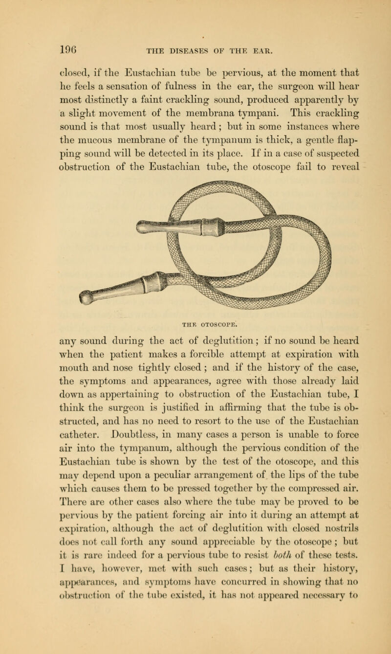 closed, if the Eustachian tube be pervious, at the moment that he feels a sensation of fulness in the ear, the surgeon will hear most distinctly a faint crackling sound, produced apparently by a slight movement of the membrana tympani. This crackling sound is that most usually heard ; but in some instances where the mucous membrane of the tympanum is thick, a gentle flap- ping sound will be detected in its place. If in a case of suspected obstruction of the Eustachian tube, the otoscope fail to reveal THE OTOSCOPE. any sound during the act of deglutition; if no sound be heard when the patient makes a forcible attempt at expiration with mouth and nose tightly closed ; and if the history of the case, the symptoms and appearances, agree with those already laid down as appertaining to obstruction of the Eustachian tube, I think the surgeon is justified in affirming that the tube is ob- structed, and has no need to resort to the use of the Eustachian catheter. Doubtless, in many cases a person is unable to force air into the tympanum, although the pervious condition of the Eustachian tube is shown by the test of the otoscope, and this may depend upon a peculiar arrangement of the lips of the tube which causes them to be pressed together by the compressed air. There are other cases also where the tube may be proved to be pervious by the patient forcing air into it during an attempt at expiration, although the act of deglutition with closed nostrils does nol call forth any sound appreciable by the otoscope ; but it is rare indeed for a pervious tube to resist both of these tests. I Imvr, however, met with such eases; but as their history, appearances, and symptoms have concurred in showing thai no obstruction of the tube existed, it has noi appeared accessary to