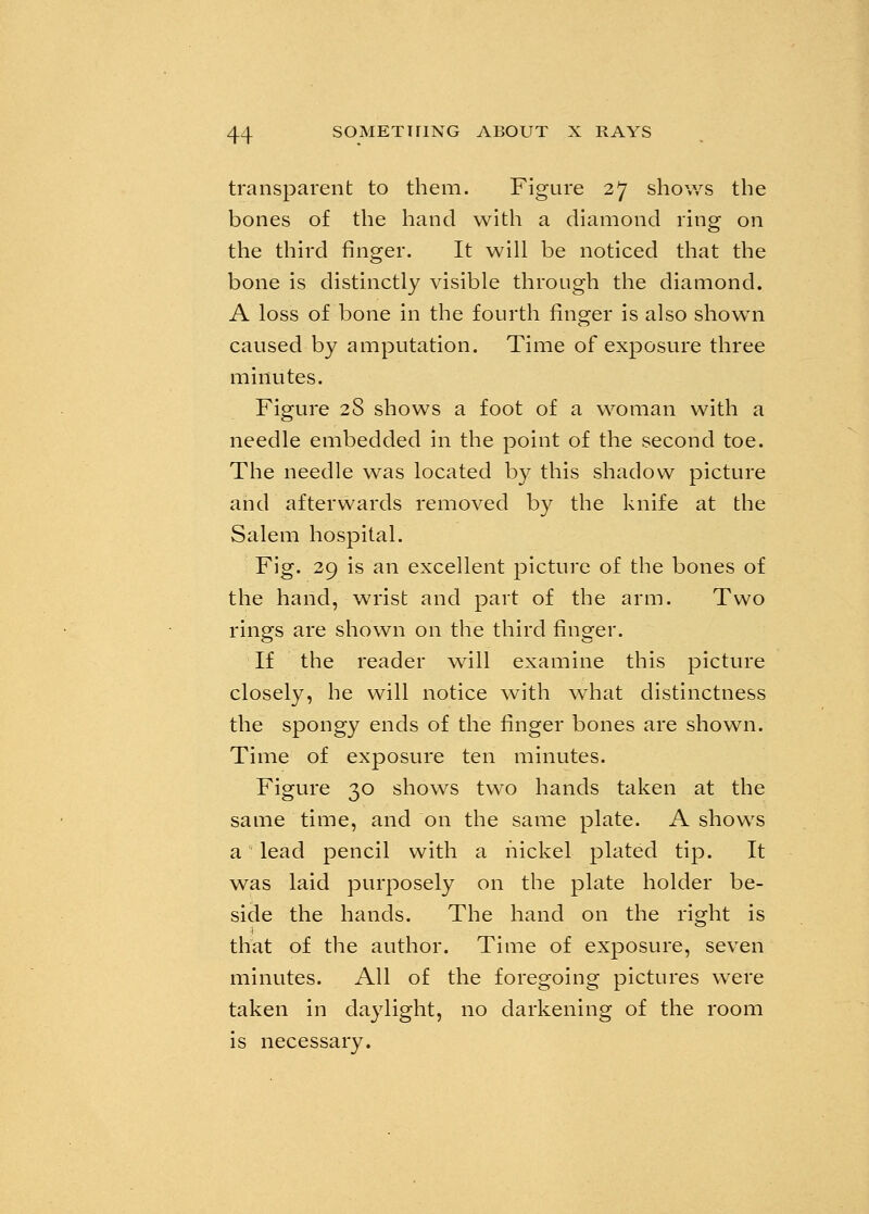 transparent to them. Figure 27 shows the bones of the hand with a diamond ring on the third finger. It will be noticed that the bone is distinctly visible through the diamond. A loss of bone in the fourth finger is also shown caused by amputation. Time of exposure three minutes. Figure 28 shows a foot of a woman with a needle embedded in the point of the second toe. The needle was located by this shadow picture and afterwards removed by the knife at the Salem hospital. Fig. 29 is an excellent picture of the bones of the hand, wrist and part of the arm. Two rings are shown on the third finger. If the reader will examine this picture closely, he will notice with what distinctness the spongy ends of the finger bones are shown. Time of exposure ten minutes. Figure 30 shows two hands taken at the same time, and on the same plate. A shows a' lead pencil with a nickel plated tip. It was laid purposely on the plate holder be- side the hands. The hand on the right is that of the author. Time of exposure, seven minutes. All of the foregoing pictures were taken in daylight, no darkening of the room is necessary.