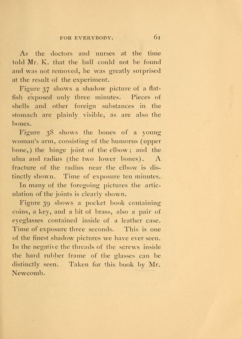 As the doctors and nurses at the time told Mr. K. that the ball could not be found and was not removed, he was greatly surprised at the result of the experiment. Figure 37 shows a shadow picture of a flat- fish exposed only three minutes. Pieces of shells and other foreign substances in the stomach are plainly visible, as are also the bones. Figure 38 shows the bones of a young woman's arm, consisting of the humorus (upper bone,) the hinge joint of the elbow ; and the ulna and radius (the two lower bones). A fracture of the radius near the elbow is dis- tinctly shown. Time of exposure ten minutes. In many of the foregoing pictures the artic- ulation of the joints is clearly shown. Figure 39 shows a pocket book containing coins, a key, and a bit of brass, also a pair of eyeglasses contained inside of a leather case. Time of exposure three seconds. This is one of the finest shadow pictures we have ever seen. In the negative the threads of the screws inside the hard rubber frame of the glasses can be distinctly seen. Taken for this book by Mr. Newcomb.