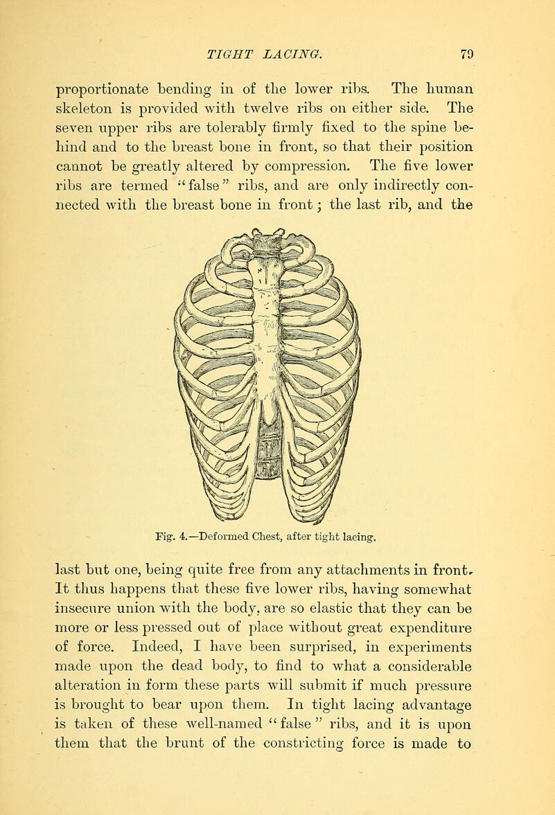 proportionate bending in of the lower ribs. The human skeleton is provided with twelve ribs on either side. The seven upper ribs are tolerably firmly fixed to the spine be- hind and to the breast bone in front, so that their position cannot be greatly altered by compression. The five lower ribs are termed ■' false ribs, and are only indirectly con- nected with the breast bone in front; the last rib, and the Fig1. 4— Deformed Chest, after tight lacing1. last but one, being quite free from any attachments in front. It thus happens that these five lower ribs, having somewhat insecure union with the body, are so elastic that they can be more or less pressed out of place without great expenditure of force. Indeed, I have been surprised, in experiments made upon the dead body, to find to what a considerable alteration in form these parts will submit if much pressure is brought to bear upon them. In tight lacing advantage is taken of these well-named  false  ribs, and it is upon them that the brunt of the constricting force is made to