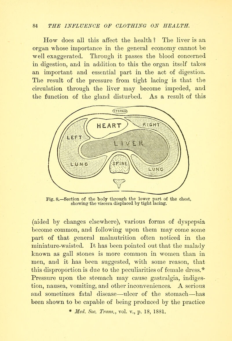 How does all this affect the health 1 The liver is an organ whose importance in the general economy camiot be well exaggerated. Through it passes the blood concerned in digestion, and in addition to this the organ itself takes an important and essential part in the act of digestion. The result of the pressure from tight lacing is that the circulation through the liver may become impeded, and the function of the gland disturbed. As a result of this Fig. 8.—Section of the body through, the lower part of the chest, showing the viscera displaced by tight lacing. (aided by changes elsewhere), various forms of dyspepsia become common, and following upon them may come some part of that general malnutrition often noticed in the miniature-waisted. It has been pointed out that the malady known as gall stones is more common in women than in men, and it has been suggested, with some reason, that this disproportion is due to the peculiarities of female dress.* Pressure upon the stomach may cause gastralgia, indiges- tion, nausea, vomiting, and other inconveniences. A serious and sometimes fatal disease—ulcer of the stomach—has been shown to be capable of being produced by the practice * Med. Soc. Trans., vol. v., p. 18, 1881.