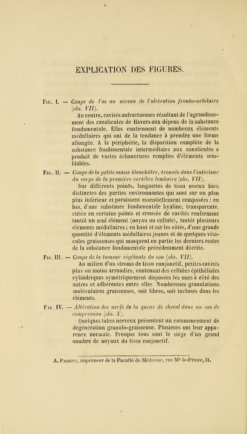 EXPLICATION DES FIGURES. FiG. I. — Coupe de l'os au niveau de rulcération fronto-orbitaire [obs. VII). Au centre, cavités anfractueuses résultant de l'agrandisse- ment des canalicules de Havers aux dépens de la substance fondamentale. Elles contiennent de nombreux éléments médullaires qui ont de la tendance à prendre une forme allongée. A la périphérie, la disparition complète de la substance fondamentale intermédiaire aux canalicules a produit de vastes échancrures remplies d'éléments sem- blables. FiG. II. — Cou}:)e delà petite masse blanchâtre, trouvée dans Vintérieur du corps de la première vertèbre lombaire (obs. VII). Sur différents points, languettes de tissu osseux bien distinctes des parties environnantes qui sont sur un plan plus inférieur et paraissent essentiellement composées : en bas, d'une substance fondamentale hyaline, transparente, striée en certains points et creusée de cavités renfermant tantôt un seul élément (noyau ou cellule), tantôt plusieurs éléments médullaires ; en haut et sur les côtés, d'une grande quantité d'éléments médullaires jeunes et de quelques vési- cules graisseuses qui masquent en partie les derniers restes de la substance fondamentale précédemment décrite. FiG, III. — Coupe de la tumeur végétante du cou (obs. VII). Au milieu d'un stroma de lissu conjonctif, petites cavités plus ou moins arrondies, contenant des cellules épithéliales cylindriques symétriquement disposées les unes à côté des autres et adhérentes entre elles Nombreuses granulations moléculaires graisseuses, soit libres, soit incluses dans les éléments. F16. IV. — Altération des nerfs de la queue de cheval dans iin cas de compression (obs. X). Quelques tubes nerveux présentent un commencement de dégénération granulo-graisseuse. Plusieurs ont leur appa- rence normale. Presque tous sont le siège d'un grand nombre de noyaux du tissu conjonctif. A. Parent, imprimeur de la Faculté de Médecine, rue Mf-le-Prince, 31.