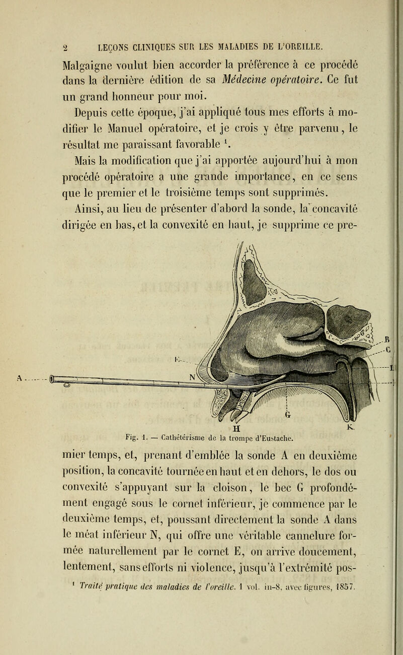 Malgaigne voulut bien accorder la préférence à ce procédé dans la dernière édition de sa Médecine opératoire. Ce fut un grand honneur pour moi. Depuis cette époque, j'ai appliqué tous mes efforts à mo- difier le Manuel opératoire, et je crois y être parvenu, le résultat me paraissant favorable l. Mais la modification que j'ai apportée aujourd'hui à mon procédé opératoire a une grande importance, en ce sens que le premier et le troisième temps sont supprimés. Ainsi, au lieu de présenter d'abord la sonde, la'concavité dirigée en bas, et la convexité en haut, je supprime ce pre- 1. — Cathétérisme de la trompe d'Eustache mier temps, et, prenant d'emblée la sonde A en deuxième position, la concavité tournée en haut et en dehors, le dos ou convexité s'appuyant sur la cloison, le bec G profondé- ment engagé sous le cornet inférieur, je commence par le deuxième temps, et, poussant directement la sonde A dans le méat inférieur N, qui offre une véritable cannelure for- mée naturellement par le cornet E, on arrive doucement, lentement, sans efforts ni violence, jusqu'à l'extrémité pos- 1 Trait? pratique des maladies de l'oreille. 1 vol. iii-8. avec figures, 1857.