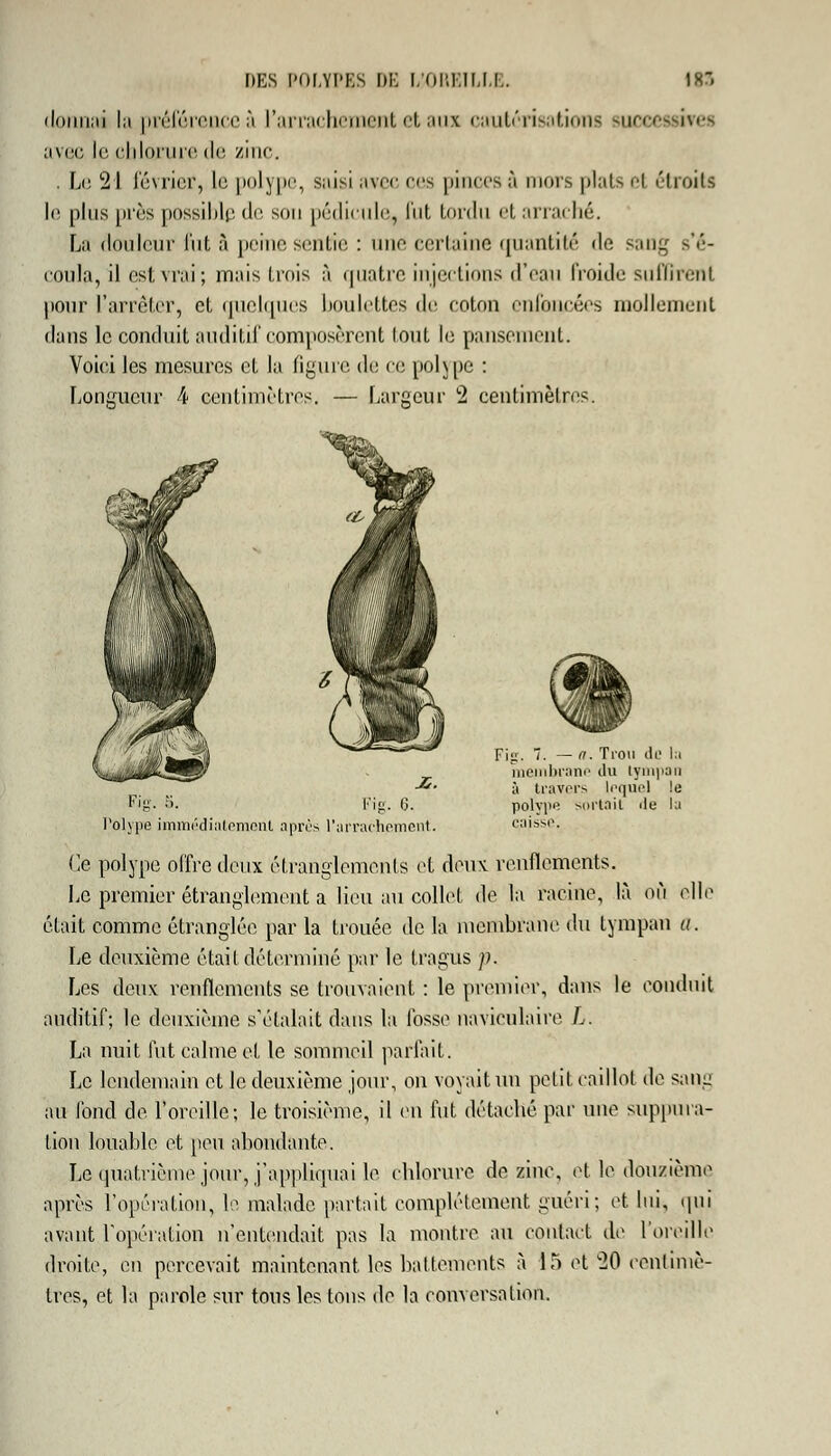 ilninKii la préférence à l'arrachement et aux cautérisations successives avec le chlorure de zinc. . Le 21 lévrier, le polype, saisi avec ces pinces à mors plats el étroite le plus près possible de son pédicule, fut tordu et arraché. La douleur fut à peine sentie : une certaine quantité de sang s'é- coula, il est vrai; mais trois à quatre injections d'eau froide suffirent pour l'arrêter, et quelques boulettes de coton enfoncées mollement dans le conduit auditif composèrent louL le pansement. Voici les mesures et la figure de ce polype : Longueur 4 centimètres. — Largeur 2 centimètres. Fig. S. Fig. (3. Polype immédiatement après l'arrachement. Fig. 7. — a. Trou de la membrane du tympan à travers lequel le polvpe sortait de la caisse. Ce polype offre deux étranglements et deux, renflements. Le premier étranglement a lieu au collet de la racine, là on elle était comme étranglée par la trouée de la membrane du tympan a. Le deuxième était déterminé par le tragus p. Les deux renflements se trouvaient : le premier, dans le conduit auditif; le deuxième s'étalait dans la fosse naviculaire L. La nuit fut calme et le sommeil parfait. Le lendemain et le deuxième jour, on voyait un petit caillot de sang au fond de l'oreille; le troisième, il en fut détaché par une suppura- tion louable, et peu abondante. Le quatrième jour, j'appliquai le chlorure de zinc, et le douzième après l'opération, le malade partait complètement guéri; et lui, qui avant l'opération n'entendait pas la montre au contact de l'oreille droite, en percevait maintenant les battements à 15 et 20 centimè- tres, et l'a parole sur tous lestons de la conversation.