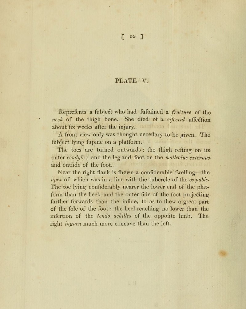 C 12 I PLATE V. Reprefents a fubje<?l; who had fuftained a fraBure of the neck of the thigh bone. She died of a rifceral affection about fix weeks after the injury, A front view only was thought neceffary to be given. The fubje6t lying fupine on a platform. The toes are turned outwards; the thigh reiting on its outer condyle; and the leg and foot on the malleolus extermis and outfide of the foot. Near the right flank is fliewn a confiderable fwelling—the apex of which was in a line with the tubercle of the ospubis. The toe lying confiderably nearer the lower end of the plat- form than the heel, and the outer fide of the foot projecting farther forwards than the infide, fo as to fliew a great part of the fole of the foot; the heel reaching no lower than the infertion of the tenclo achilles of the oppofite limb. The rijrht inmien much more concave than the left.
