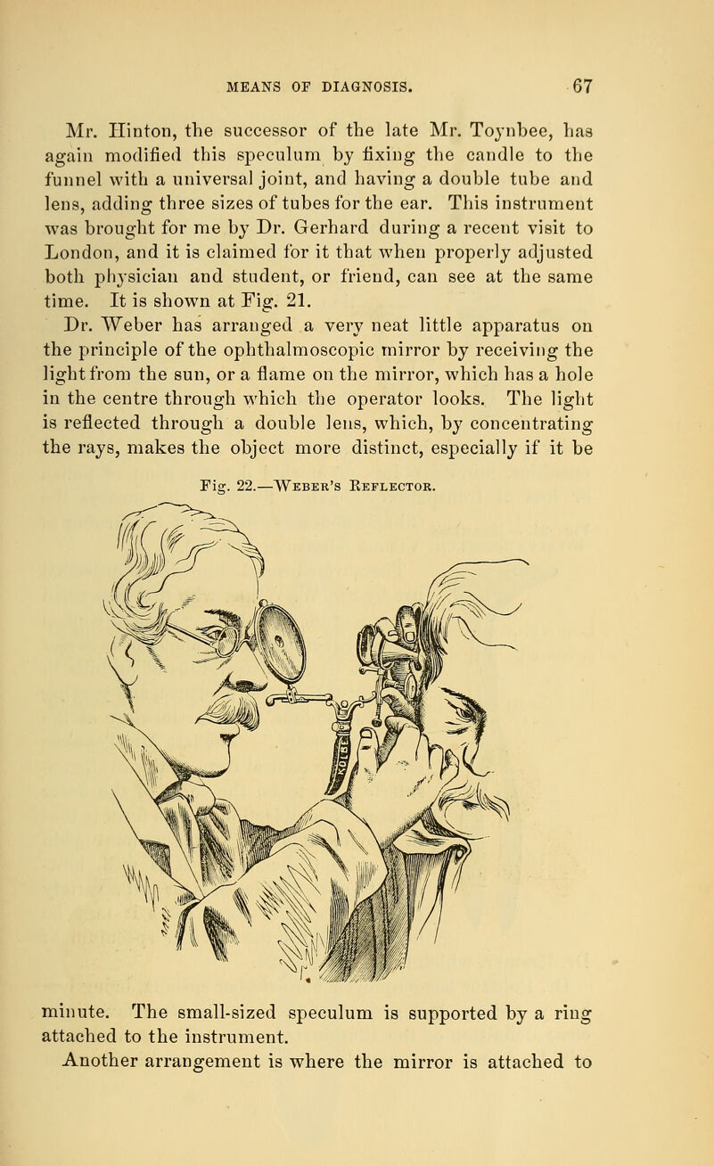 Mr. Ilinton, the successor of the late Mr. Toynbee, has again modified this speculum by fixing the candle to the funnel with a universal joint, and having a double tube and lens, adding three sizes of tubes for the ear. This instrument was brought for me by Dr. Gerhard during a recent visit to London, and it is claimed for it that when properly adjusted both physician and student, or friend, can see at the same time. It is shown at Fig. 21. Dr. Weber has arranged a very neat little apparatus on the principle of the ophthalmoscopic mirror by receiving the light from the sun, or a flame on the mirror, which has a hole in the centre through which the operator looks. The light is reflected through a double lens, which, by concentrating the rays, makes the object more distinct, especially if it be Fig. 22.—Weber's Keflector. minute. The small-sized speculum is supported by a ring attached to the instrument. Another arrangement is where the mirror is attached to