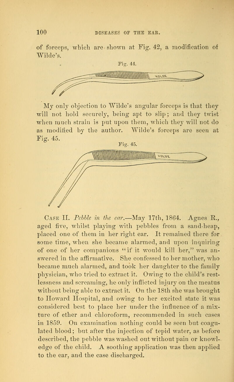 of forceps, which are shown at Fig. 42, a modification of Wilde's. Ei°;. 44. My only objection to Wilde's angular forceps is that they will not hold securely, being apt to slip; and they twist when much strain is put upon them, which they will not do as modified by the author. Wilde's forceps are seen at Fig. 45. Fi°;. 45. Case II. Pebble in the ear.—May 17th, 1864. Agnes R, aged five, whilst playing with pebbles from a sand-heap, placed one of them in her right ear. It remained there for some time, when she became alarmed, and upon inquiring of one of her companions if it would kill her, was an- swered in the affirmative. She confessed to her mother, who became much alarmed, and took her daughter to the family physician, who tried to extract it. Owing to the child's rest- lessness and screaming, he only inflicted injury on the meatus without being able to extract it. On the 18th she was brought to Howard Hospital, and owing to her excited state it was considered best to place her under the influence of a mix- ture of ether and chloroform, recommended in such cases in 1859. On examination nothing could be seen but coas;u- latecl blood; but after the injection of tepid water, as before described, the pebble was washed out without pain or knowl- edge of the child. A soothing application was then applied to the ear, and the case discharged.