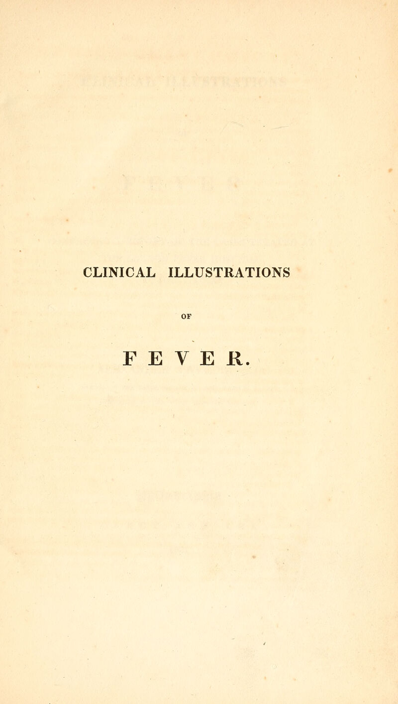 OF FEVER.