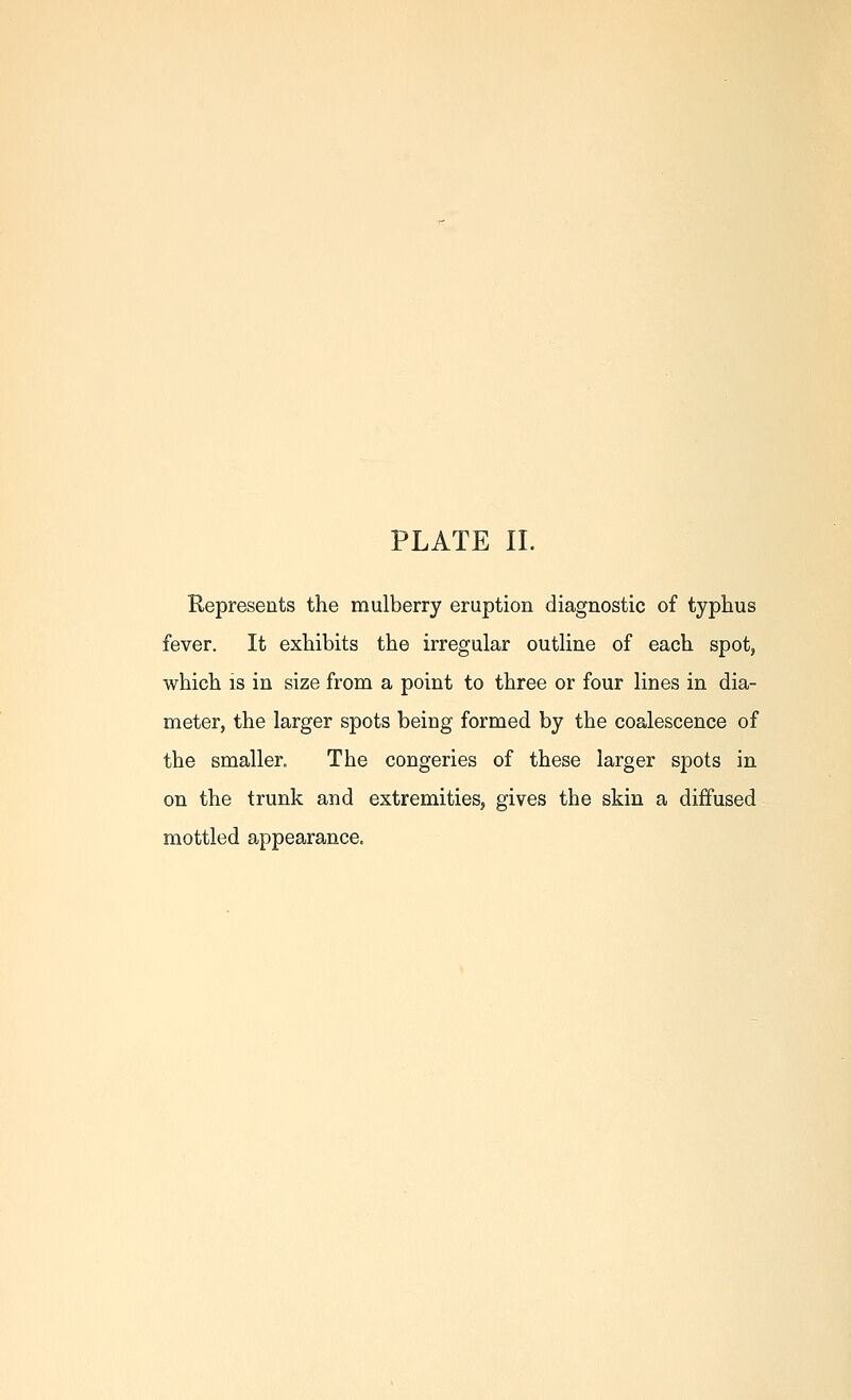 Kepresents the mulberry eruption diagnostic of typhus fever. It exhibits the irregular outline of each spot, which IS in size from a point to three or four lines in dia- meter, the larger spots being formed by the coalescence of the smaller. The congeries of these larger spots in on the trunk and extremities, gives the skin a diffused mottled appearance.