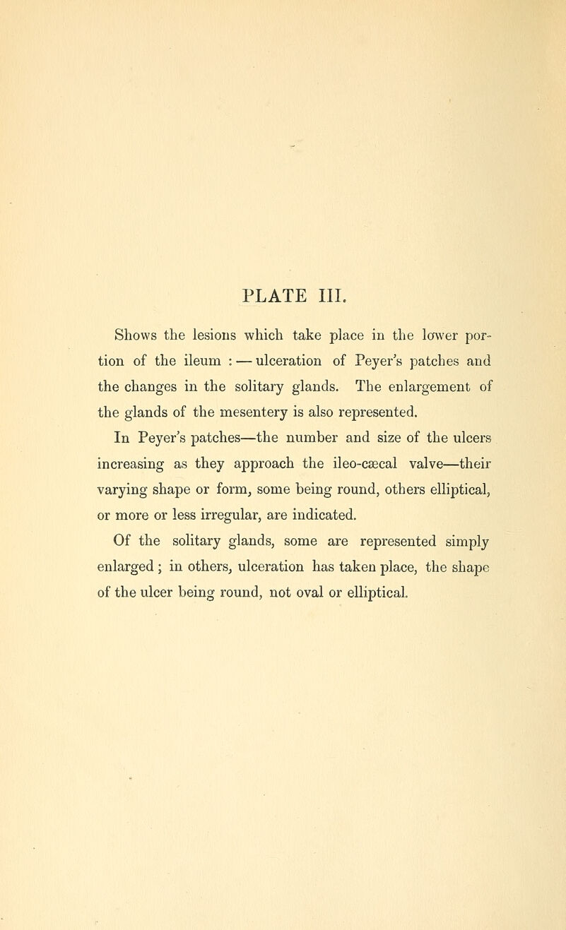 Shows the lesions which take place in the lower por- tion of the ileum : — ulceration of Peyer's patches and the changes in the solitary glands. The enlargement of the glands of the mesentery is also represented. In Peyer's patches—the number and size of the ulcers increasing as they approach the ileo-csecal valve—their varying shape or form^ some being round, others elliptical, or more or less irregular, are indicated. Of the solitary glands, some are represented simply enlarged ; in others, ulceration has taken place, the shape of the ulcer being round, not oval or elliptical.