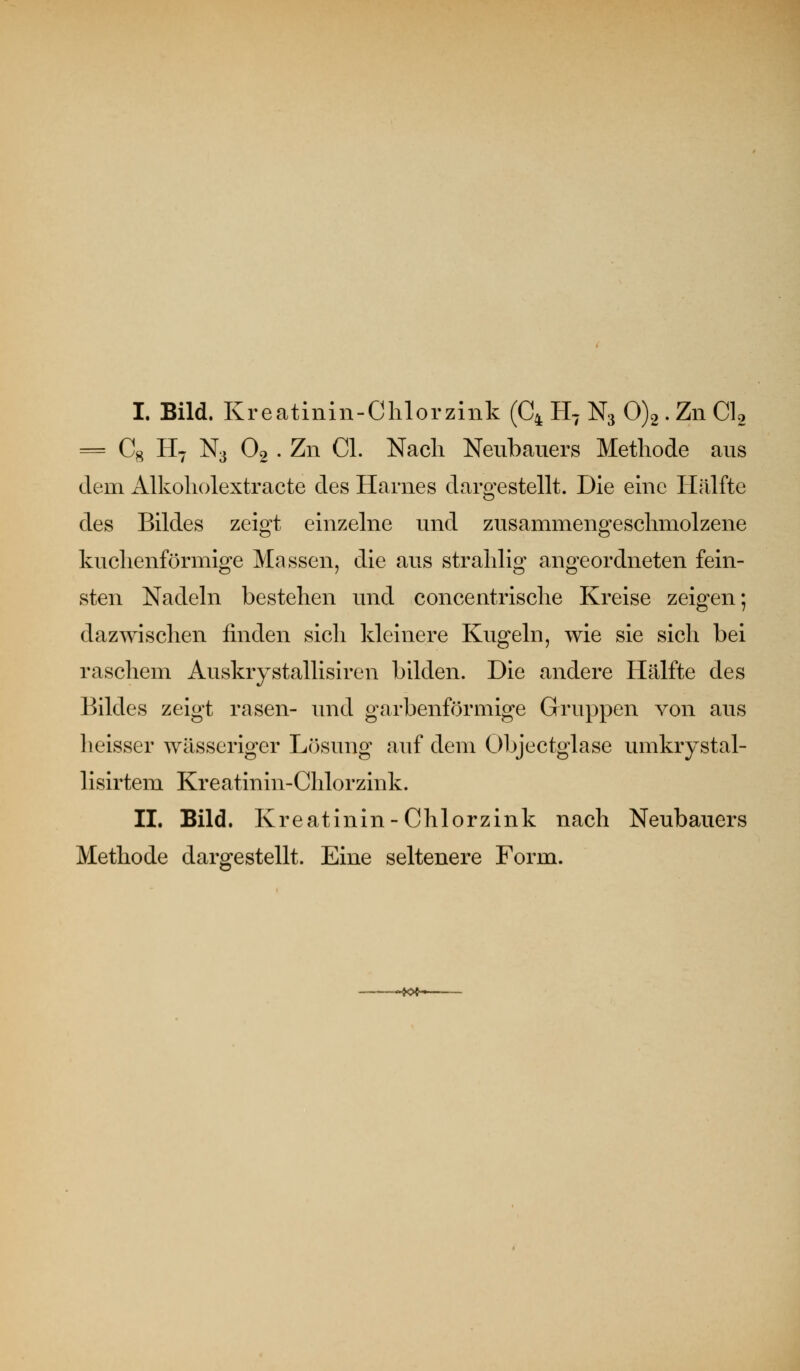 I. Bild. Kreatinin-Clilorzink (C4 H^ N3 0)2 . Zn CU = Cg H7 N3 O2 . Zn Cl. Nacli Neubauers Methode aus dem Alkoliolextracte des Harnes dargestellt. Die eine Hälfte des Bildes zeigt einzelne und zusammengeschmolzene kuchenförmige Massen, die aus strahlig angeordneten fein- sten Nadeln bestehen und concentrische Kreise zeigen; dazwischen finden sicli kleinere Kugeln, wie sie sich bei raschem Auskiystallisiren bilden. Die andere Hälfte des Bildes zeigt rasen- und garbenförmige Gruppen von aus heisser wässeriger Lösung auf dem Objectglase umkrystal- lisirtem Kreatinin-Chlorzink. IL Bild. Kreatinin-Chlorzink nach Neubauers Methode dargestellt. Eine seltenere Form. <>^o^->-