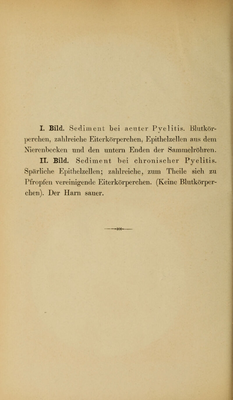 I. Bild. Sediment bei acuter Pyelitis. Blutkör- perchen, zahlreiche Eiterkörperchen, Epithelzellen aus dem Nierenbecken und den untern Enden der Sammelröhren. II. Bild. Sediment bei chronischer Pyelitis. Spärliche Epithelzellen; zahlreiche, zum Theile sich zu Pfropfen vereinigende Eiterkörperchen. (Keine Blutkörper- chen). Der Harn sauer. —-50*-