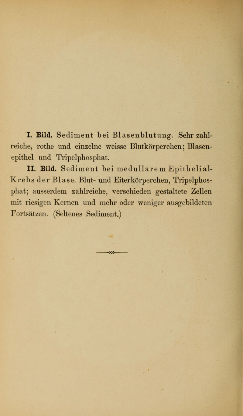 I. Bild. Sediment bei Blasenblutung. Sehr zahl- reiche, rothe und einzelne weisse Blutkörperchen; Blasen- epithel und Tripelphosphat. IL Bild. Sediment bei medulläre m Epithelial- Krebs der Blase. Blut- und Eiterkörperchen, Tripelphos- phat; ausserdem zahlreiche, verschieden gestaltete Zellen mit riesigen Kernen und mehr oder weniger ausgebildeten Fortsätzen. (Seltenes Sediment.) --40*-